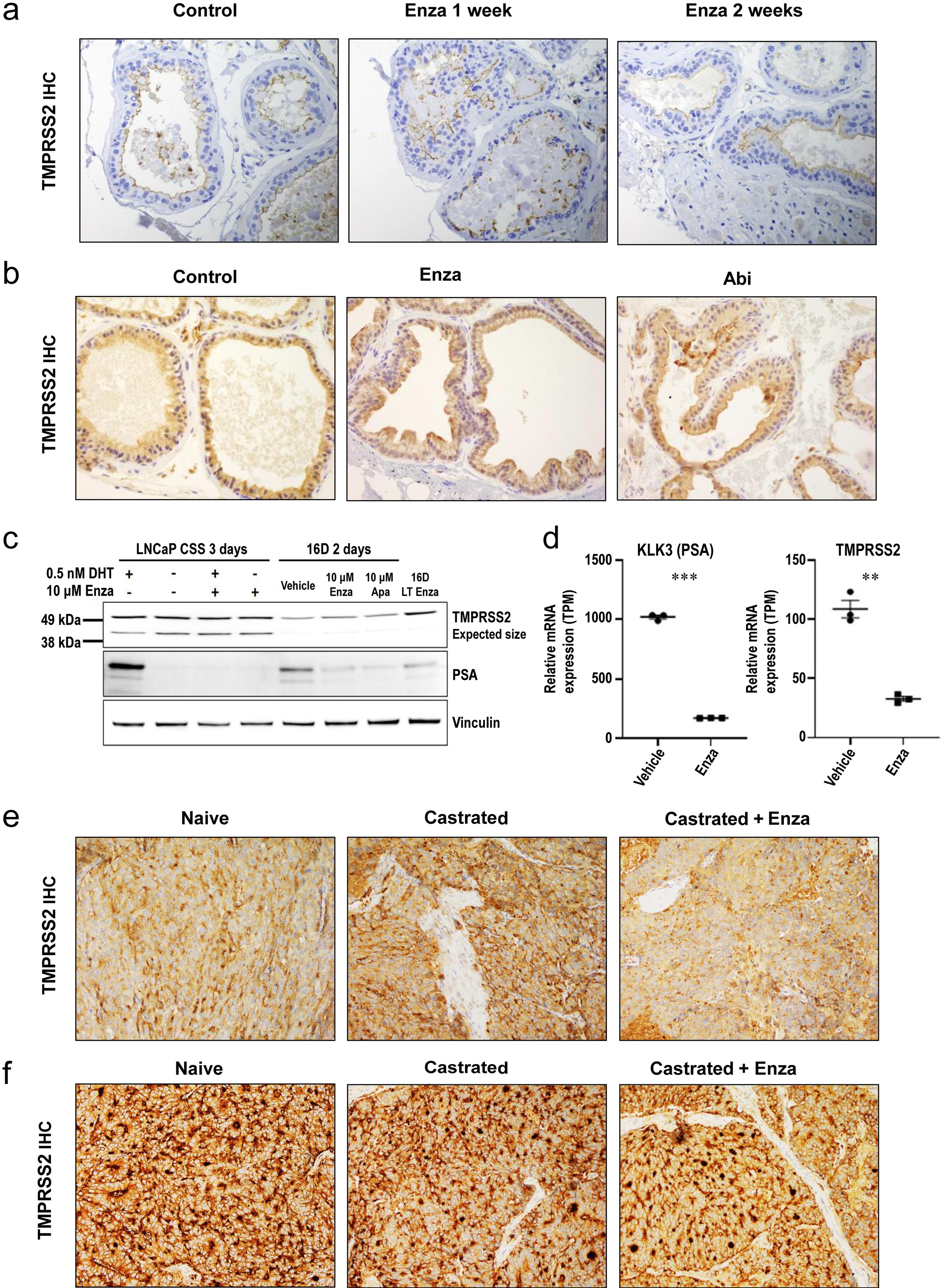 TMPRSS2 protein expression in the prostate and prostate cancer is not primarily driven by androgen.