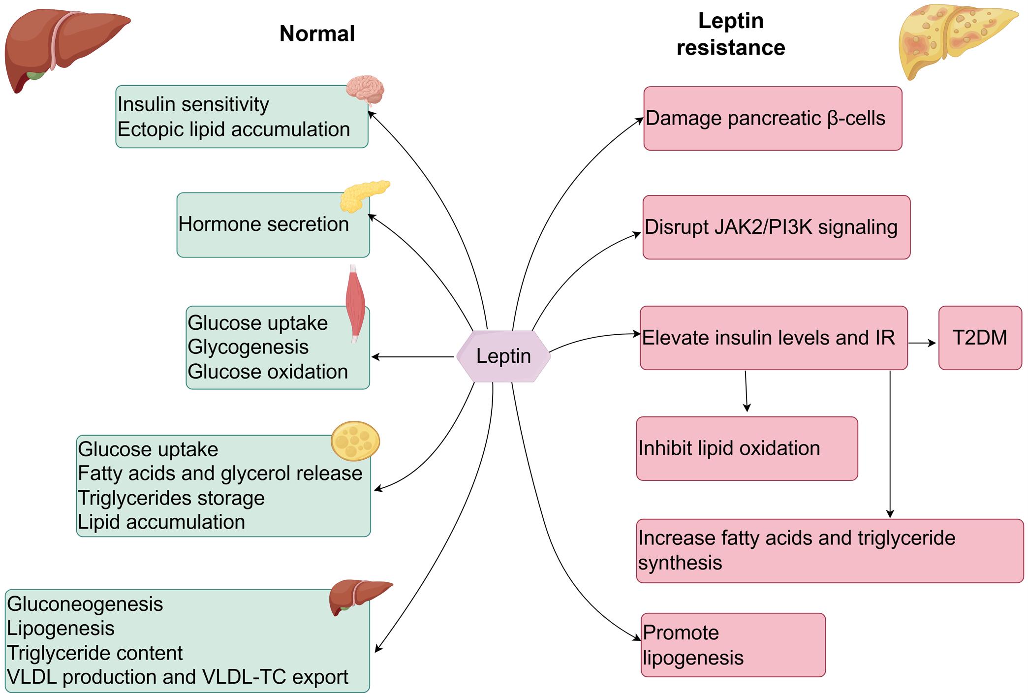 Mechanisms of insulin resistance and lipid metabolism of leptin in MAFLD.