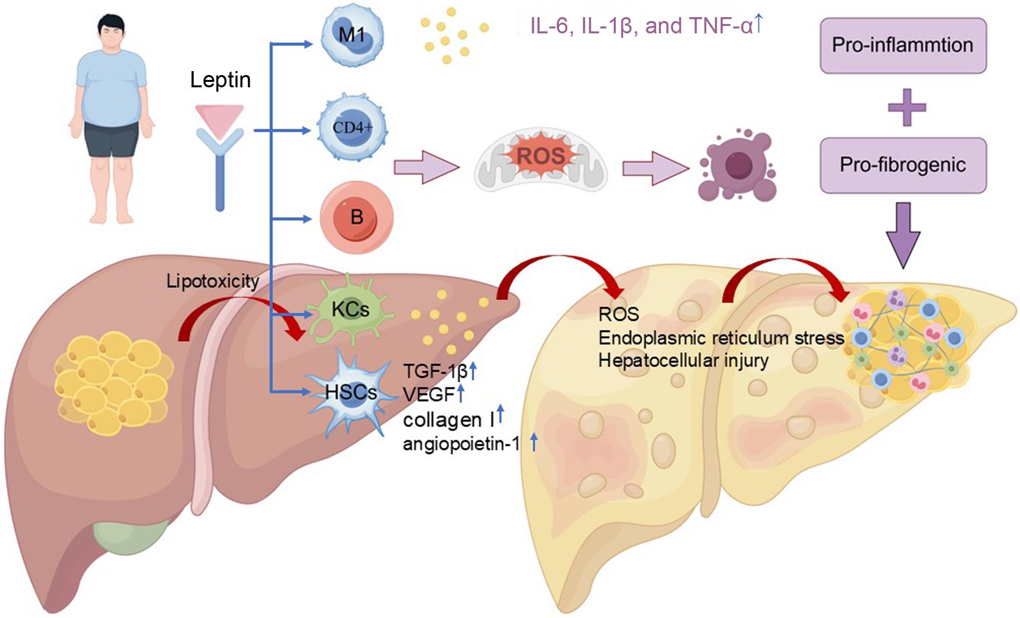 Mechanisms of inflammation and oxidative stress of leptin in MAFLD.