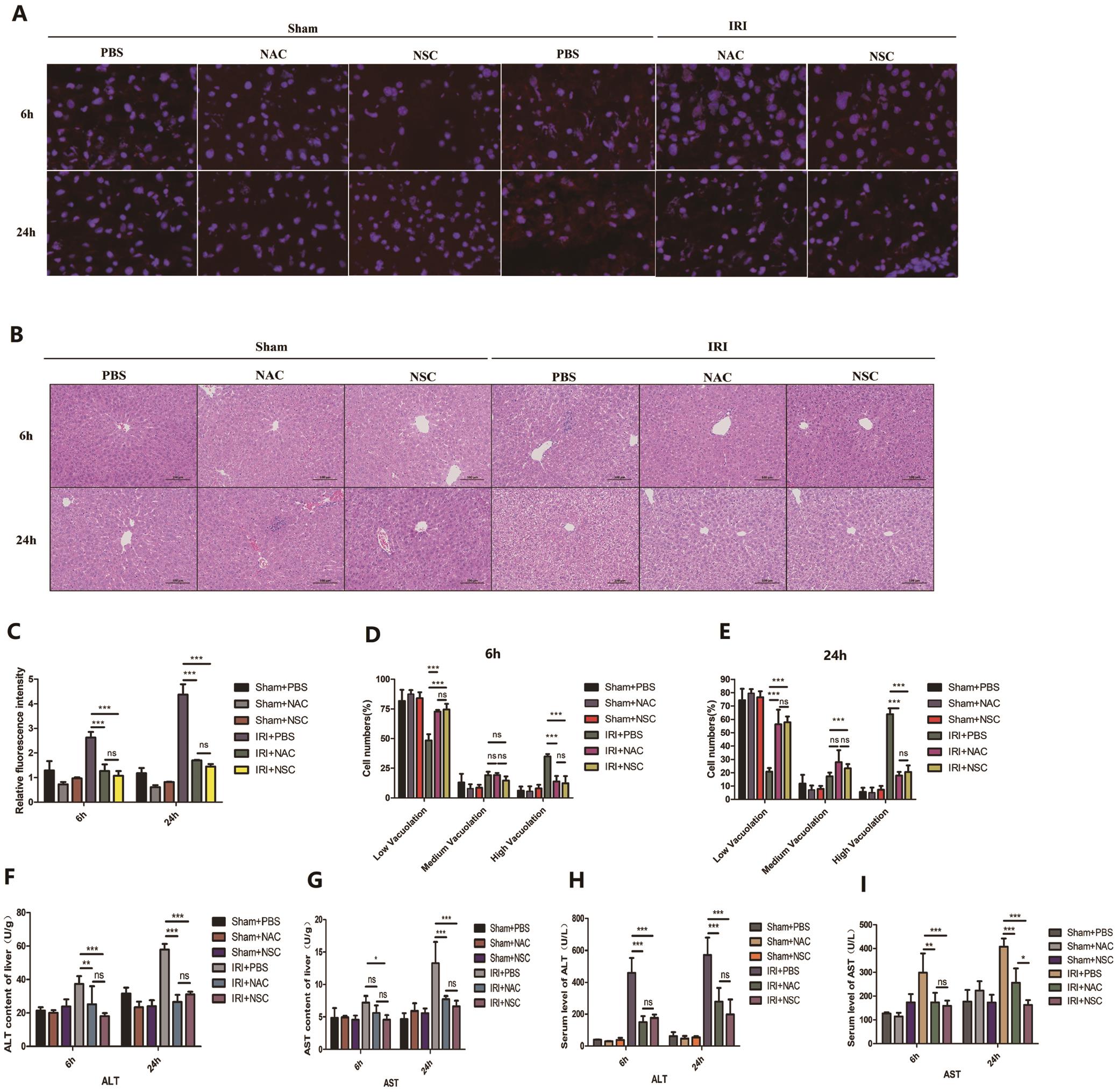 Hepatic IRI in a mouse model was alleviated by Rac1 inhibition.