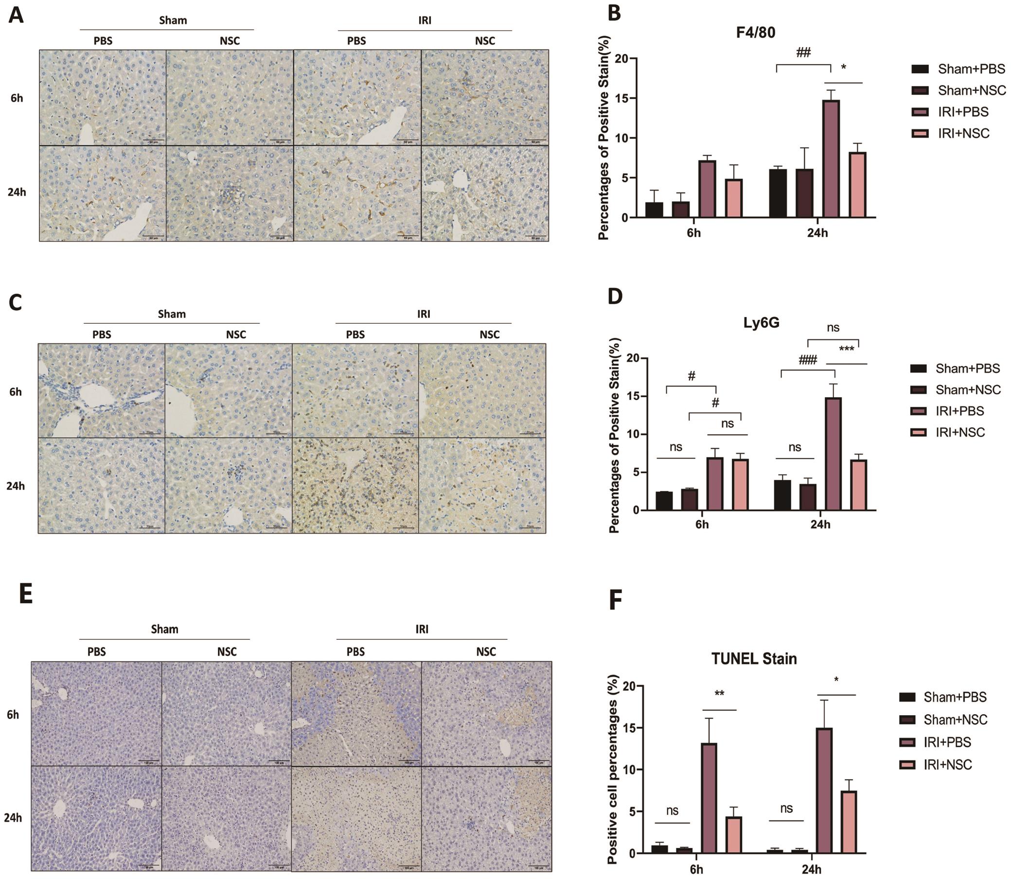 Inflammatory cell activation and hepatocellular apoptosis induced by IRI was alleviated by Rac1 inhibition.