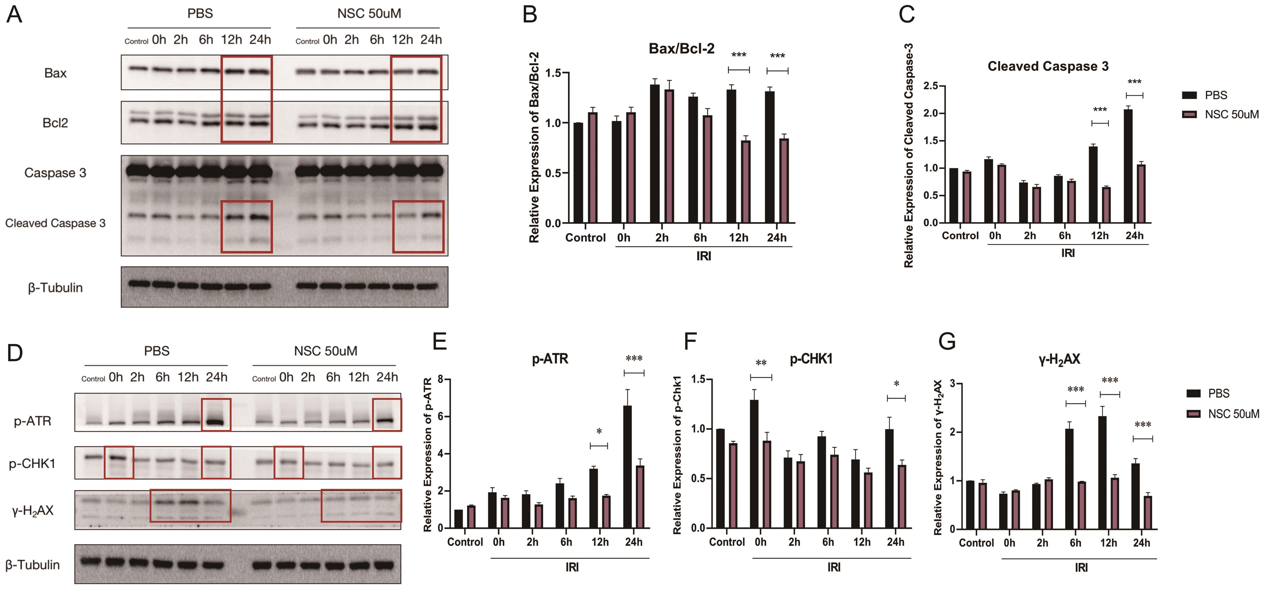 IRI-induced cell apoptosis and DNA damage were alleviated by Rac1 inhibition.