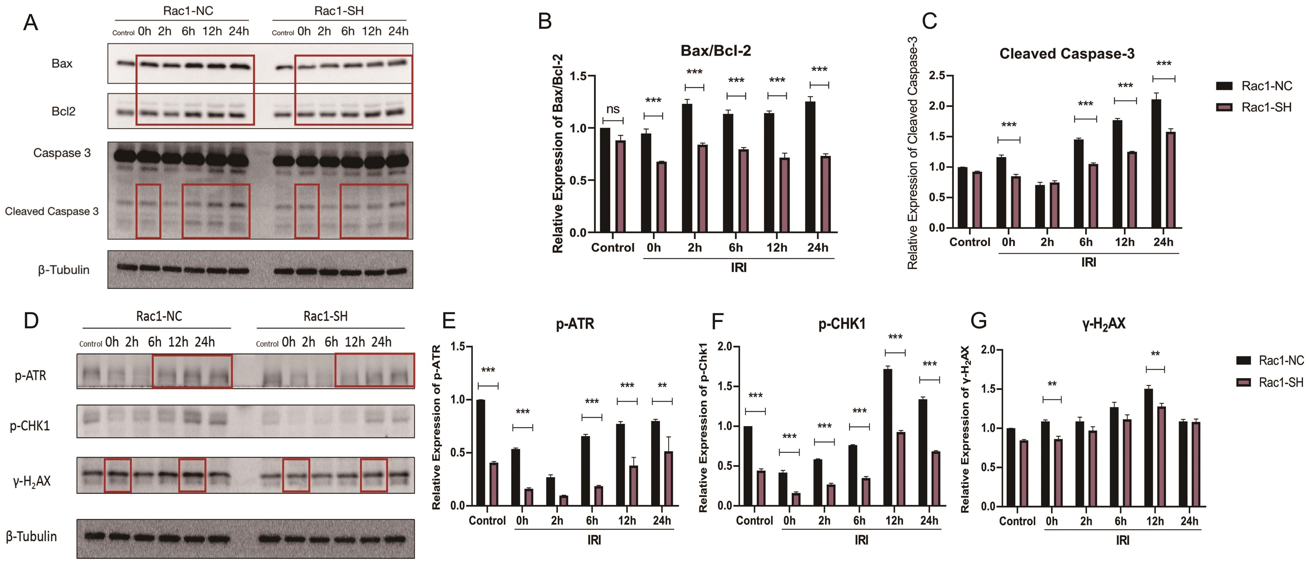 IRI-induced cell apoptosis and DNA damage were alleviated by Rac1 knockdown.