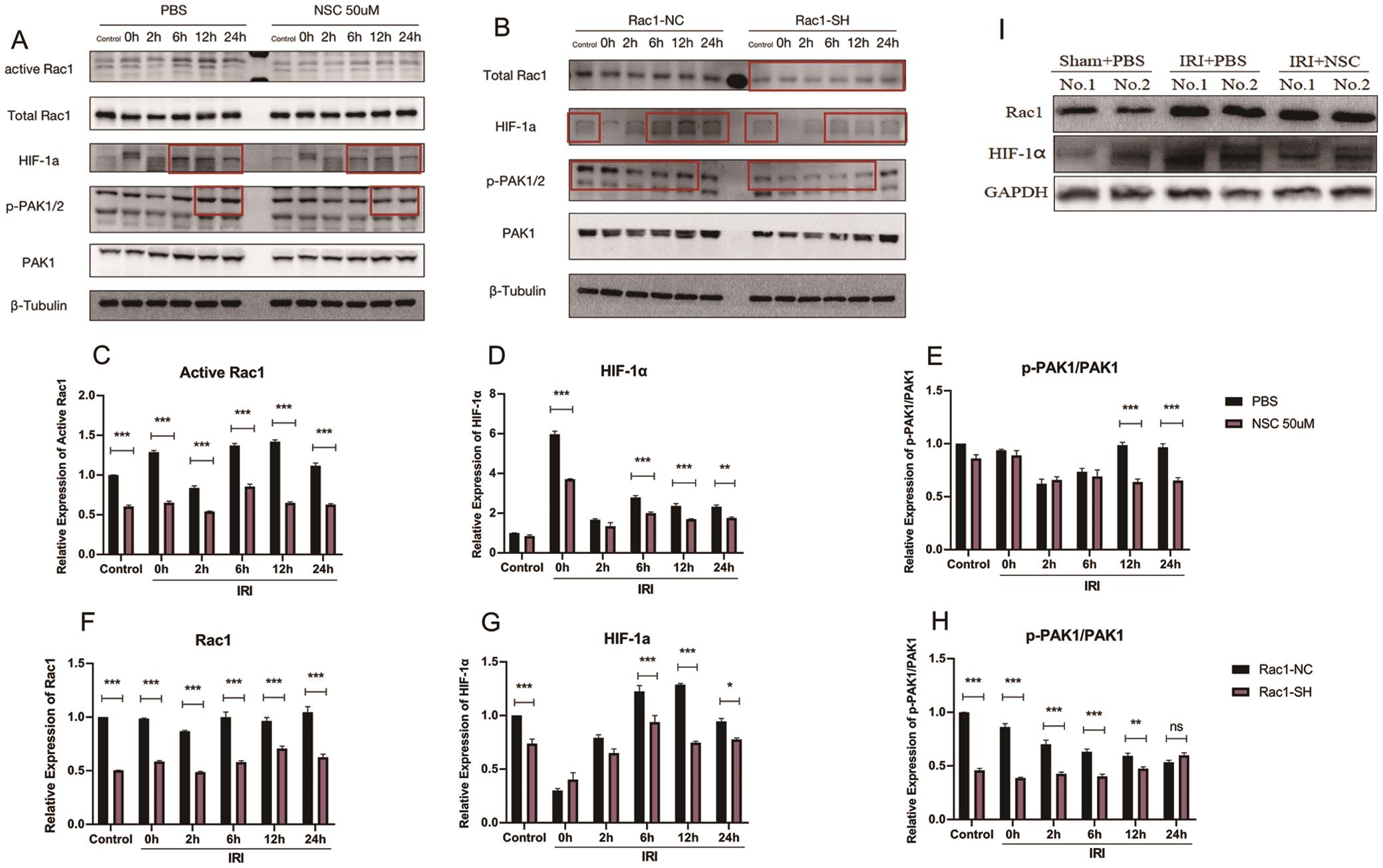 Inhibition of Rac1 reduced the prolonged up-regulation of HIF-1α induced by reperfusion.