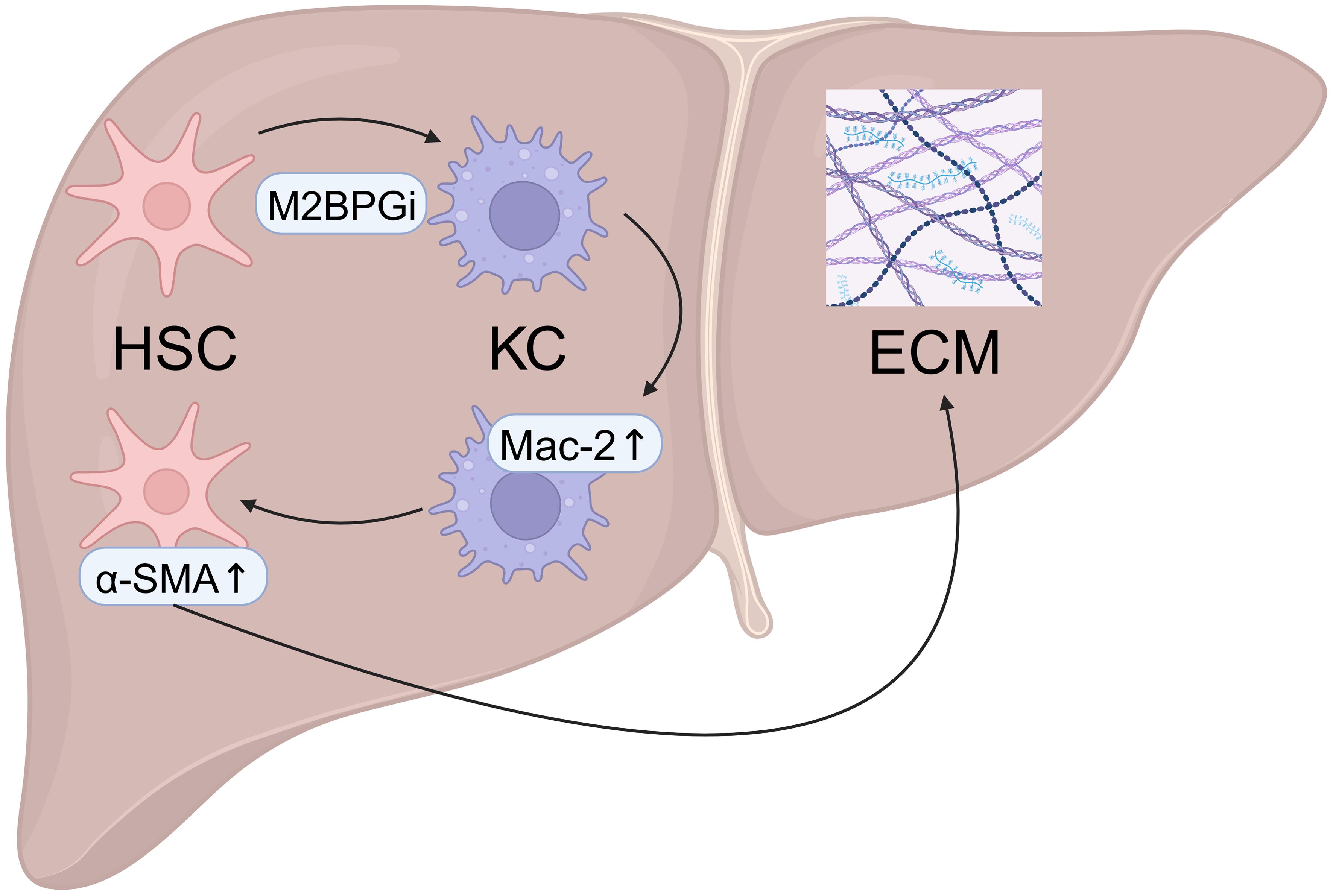Role of M2BPGi in the progression of liver fibrosis.