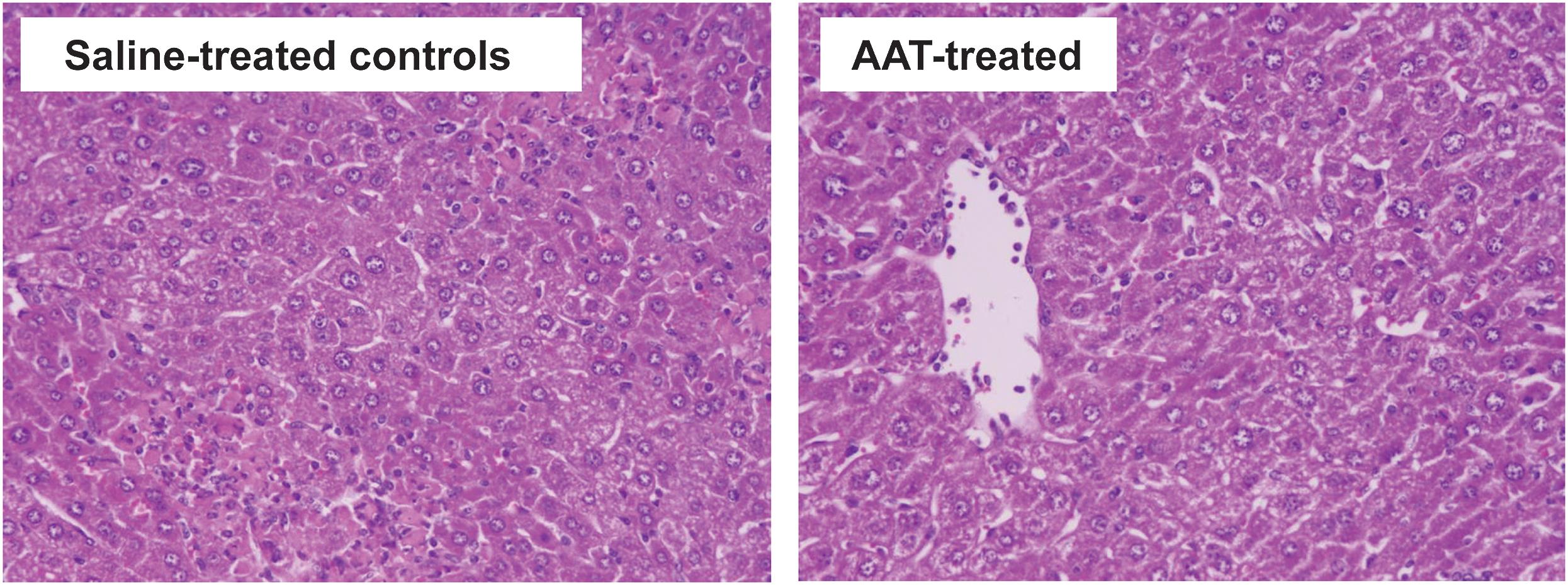 Effect of AAT on histology in the ConA-induced hepatitis model.