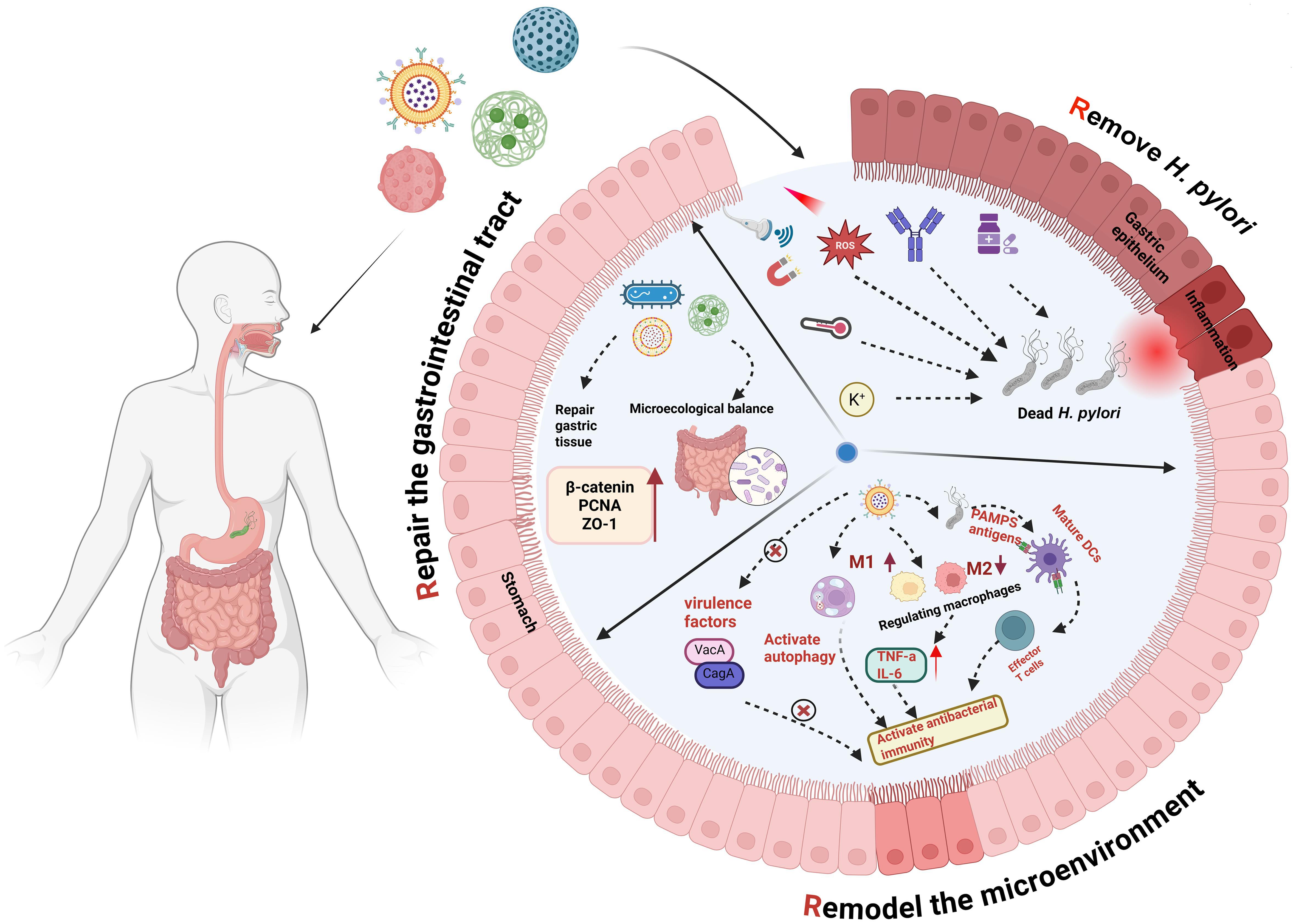 Schematic diagram of 3R (Remove, Remodel, Repair) integrated therapy for <italic>H. pylori</italic> infection based on nanomaterials.