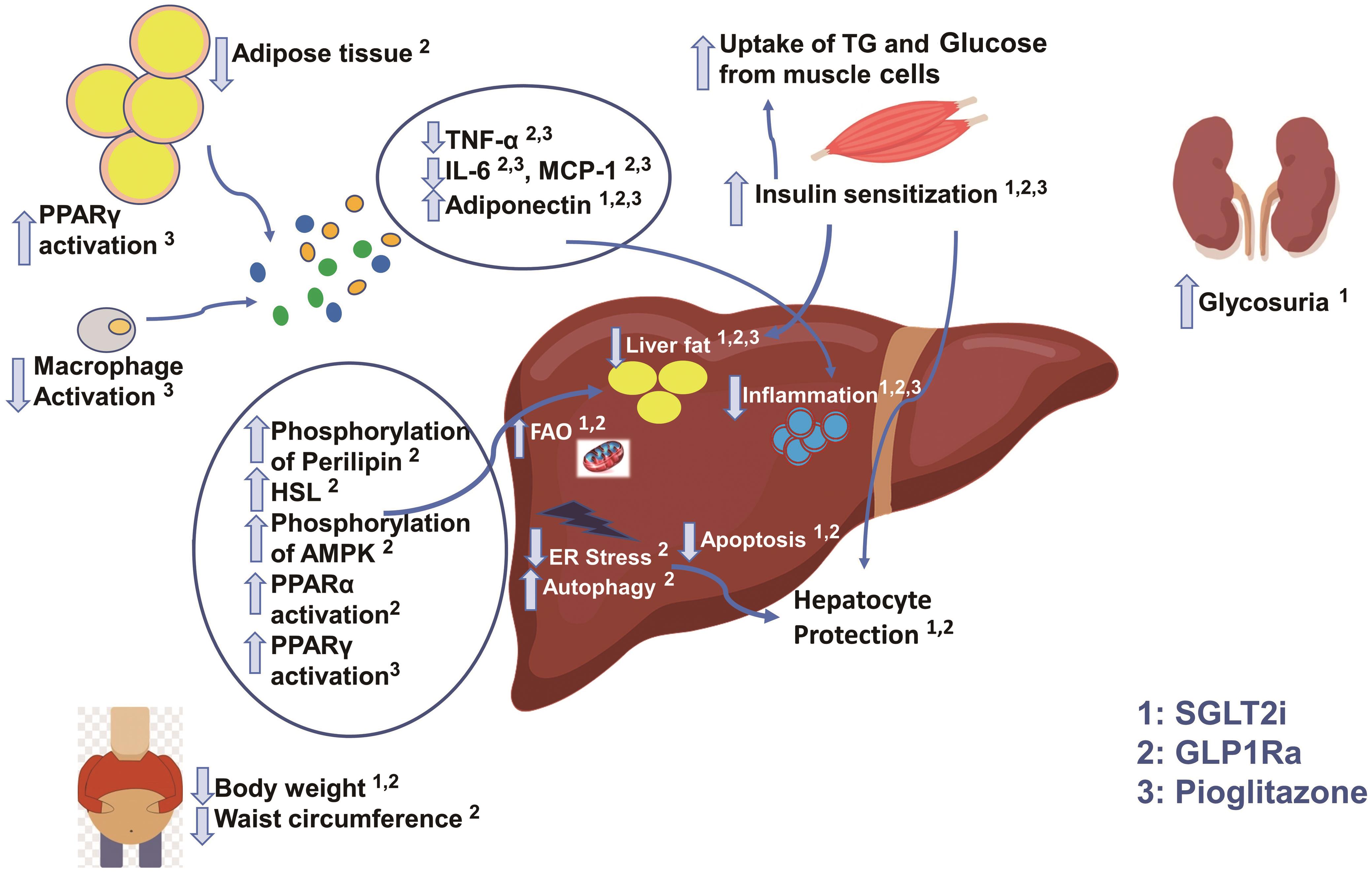 Examples of possible mechanisms of NAFLD amelioration through current antidiabetic treatment.