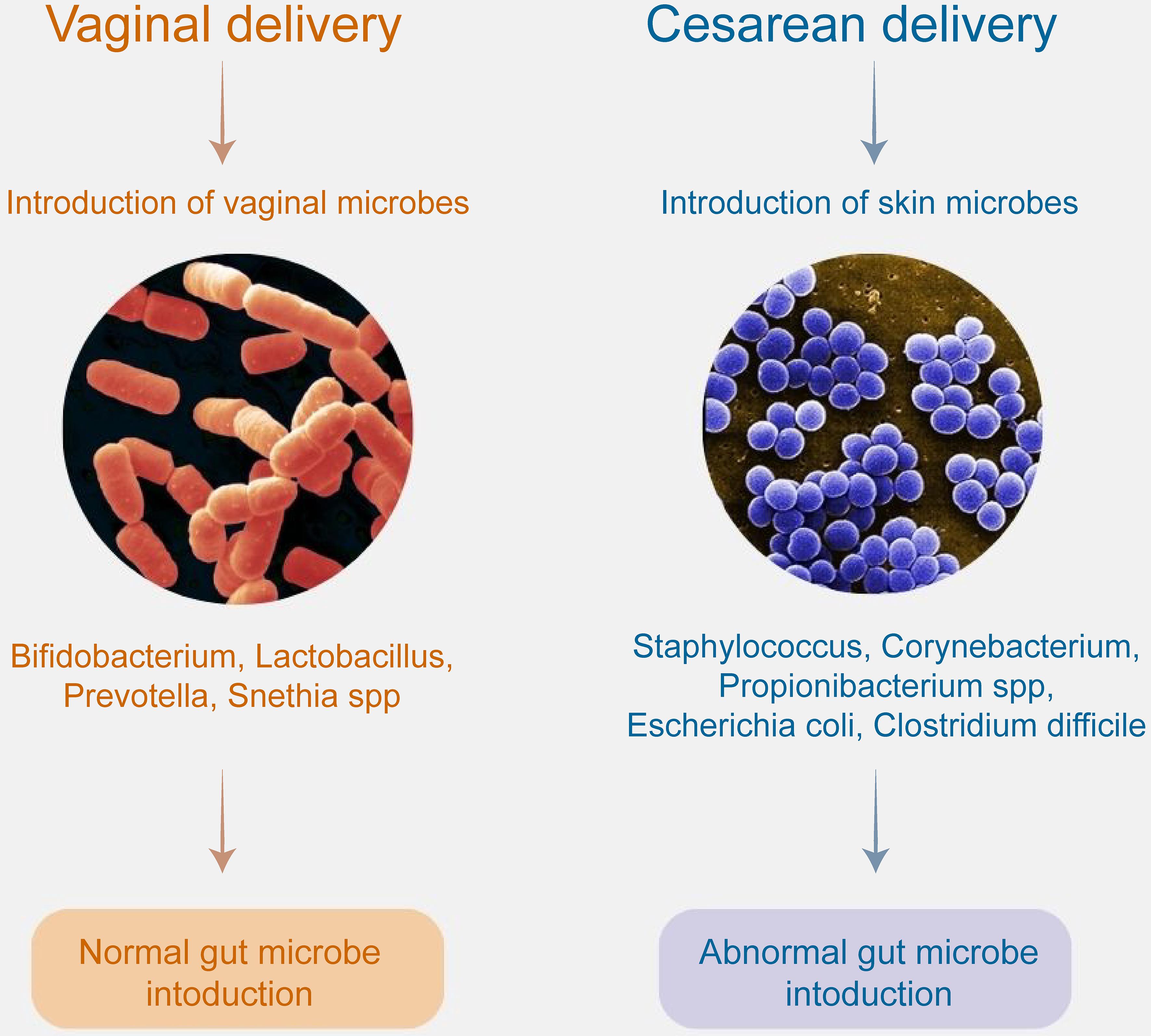 The impact of the mode of delivery on the gut microbiome in infants