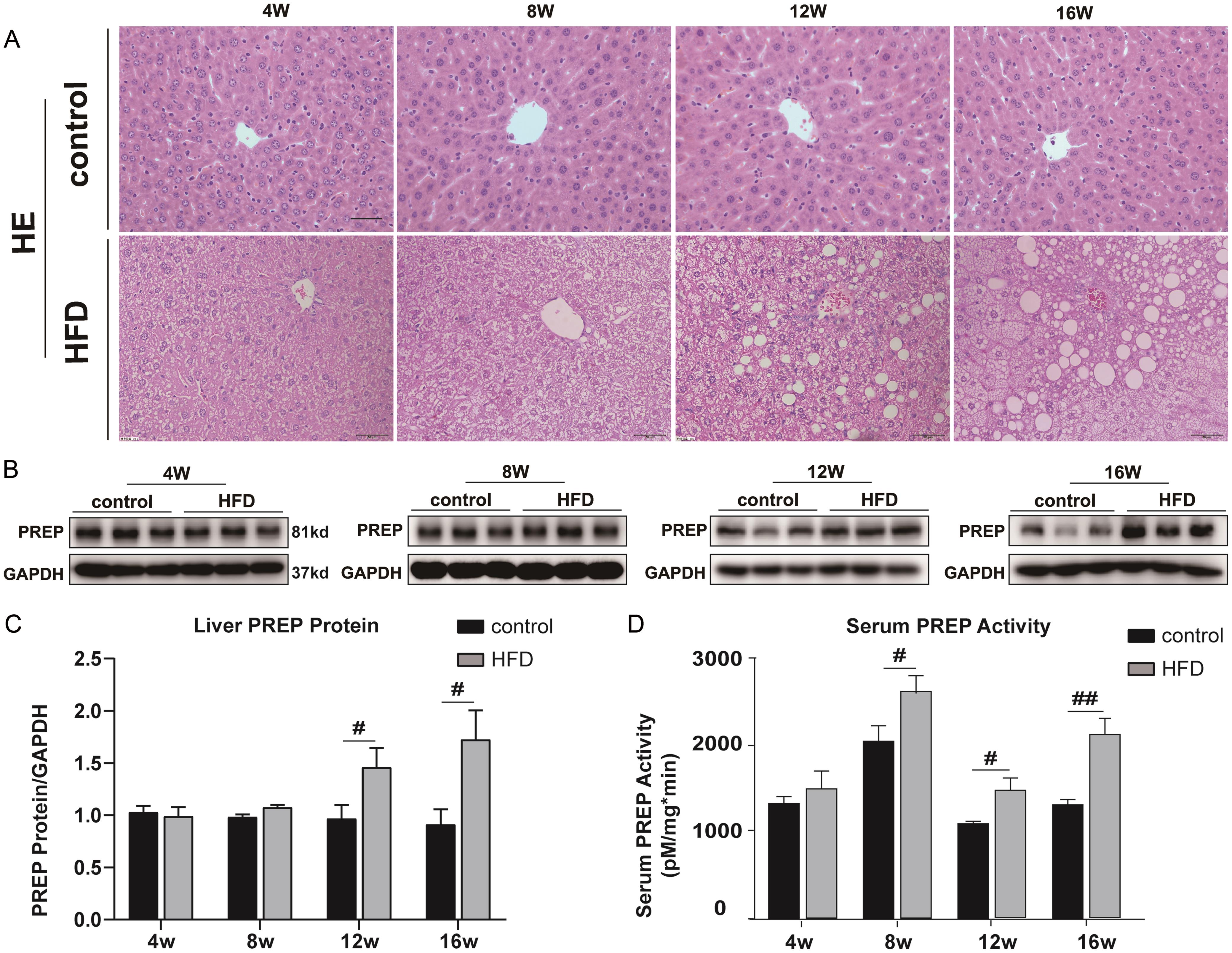 Activity and protein expression of prolyl endopeptidase (PREP) was increased during metabolic dysfunction-associated fatty liver disease (MAFLD) development.
