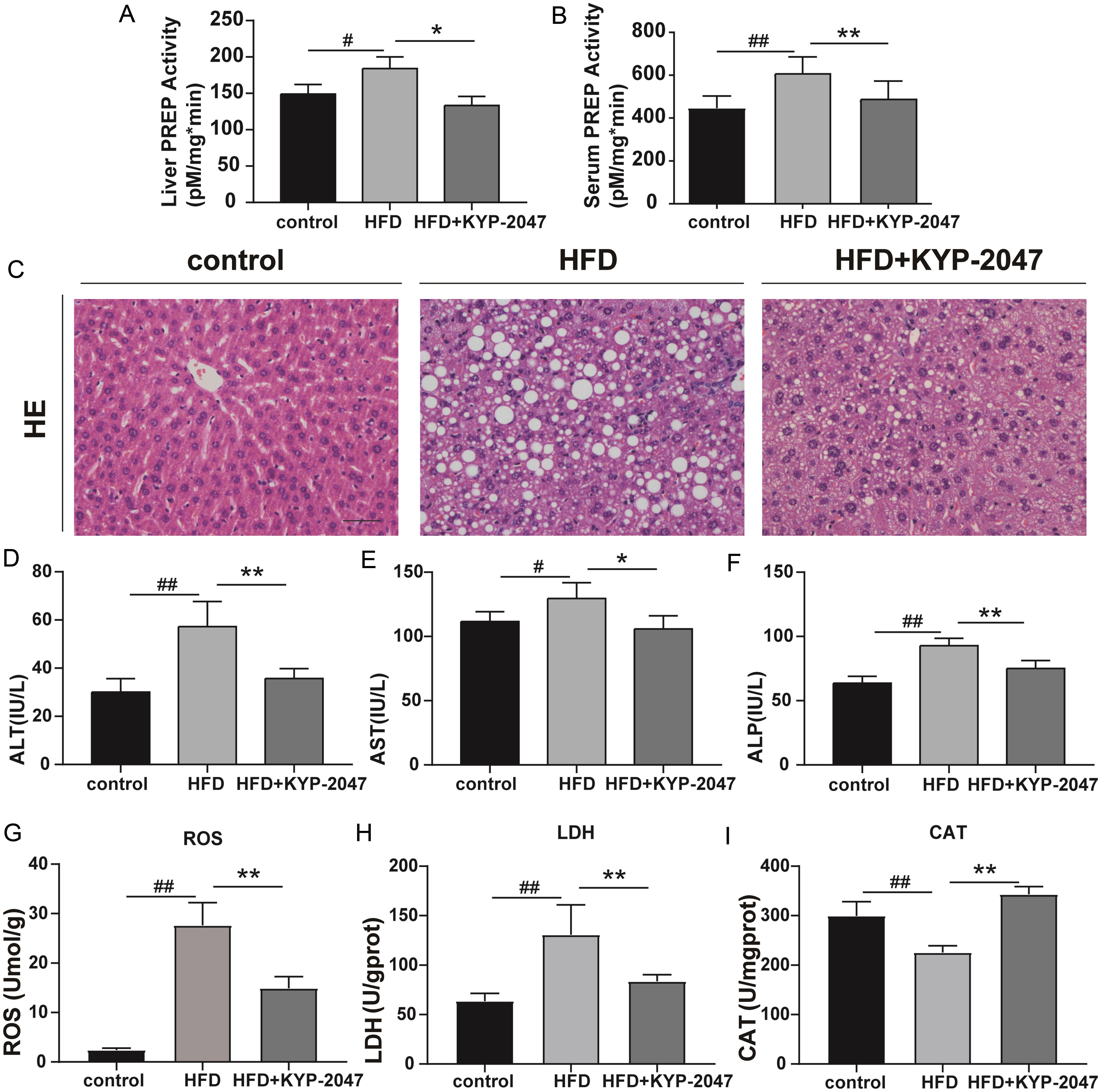 PREP inhibitor improved hepatic pathology and serological indicators of liver function in HFD-induced MAFLD.