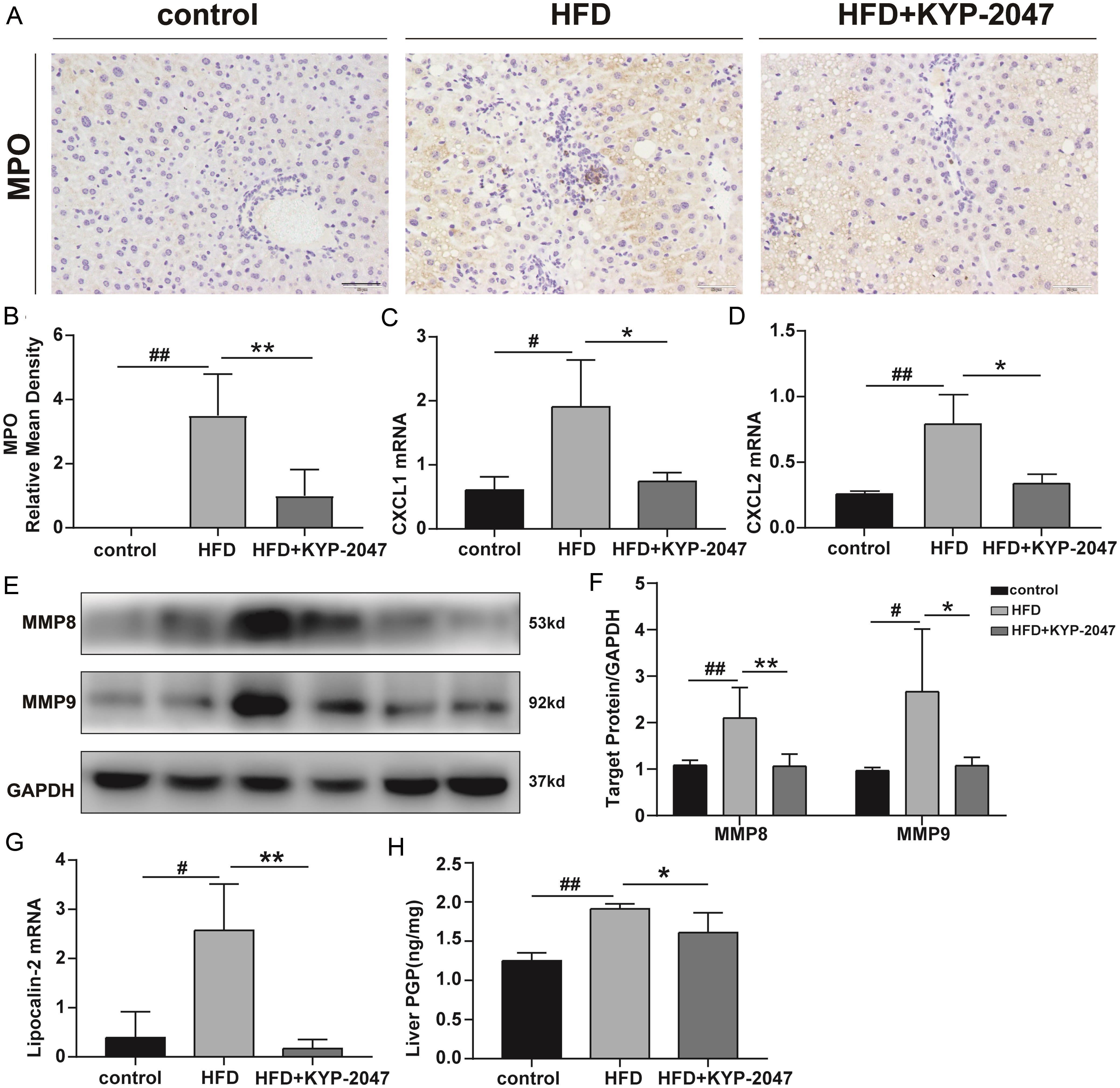 PREP inhibitor restrained the activation of MMP8/9-PREP-PGP axis and reduced hepatic neutrophil accumulation.