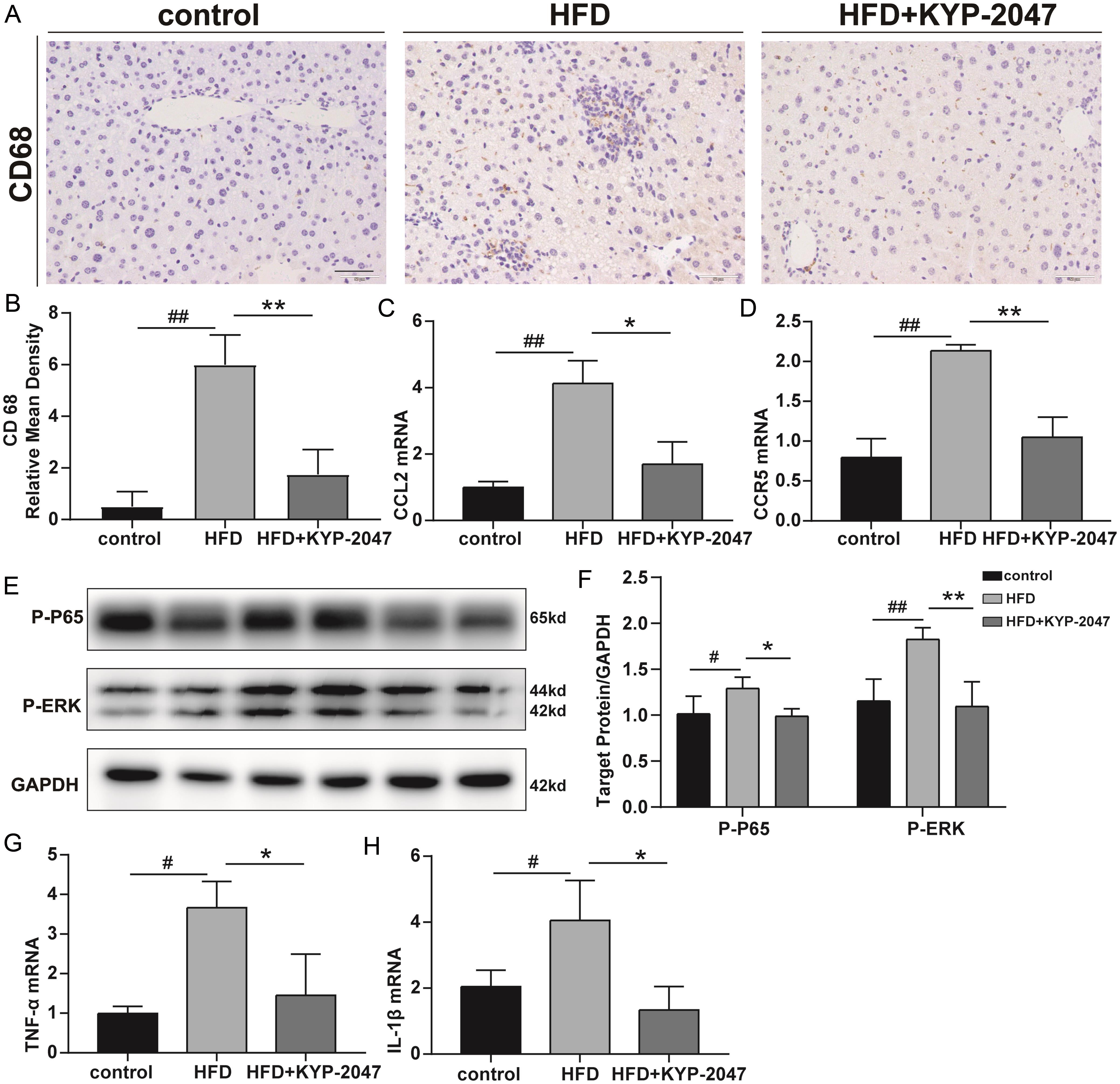 PREP inhibitor reduced hepatic macrophage accumulation and inflammation.