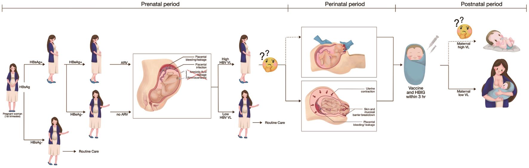 Strategies to Prevent Mothertochild Transmission of Hepatitis B Virus