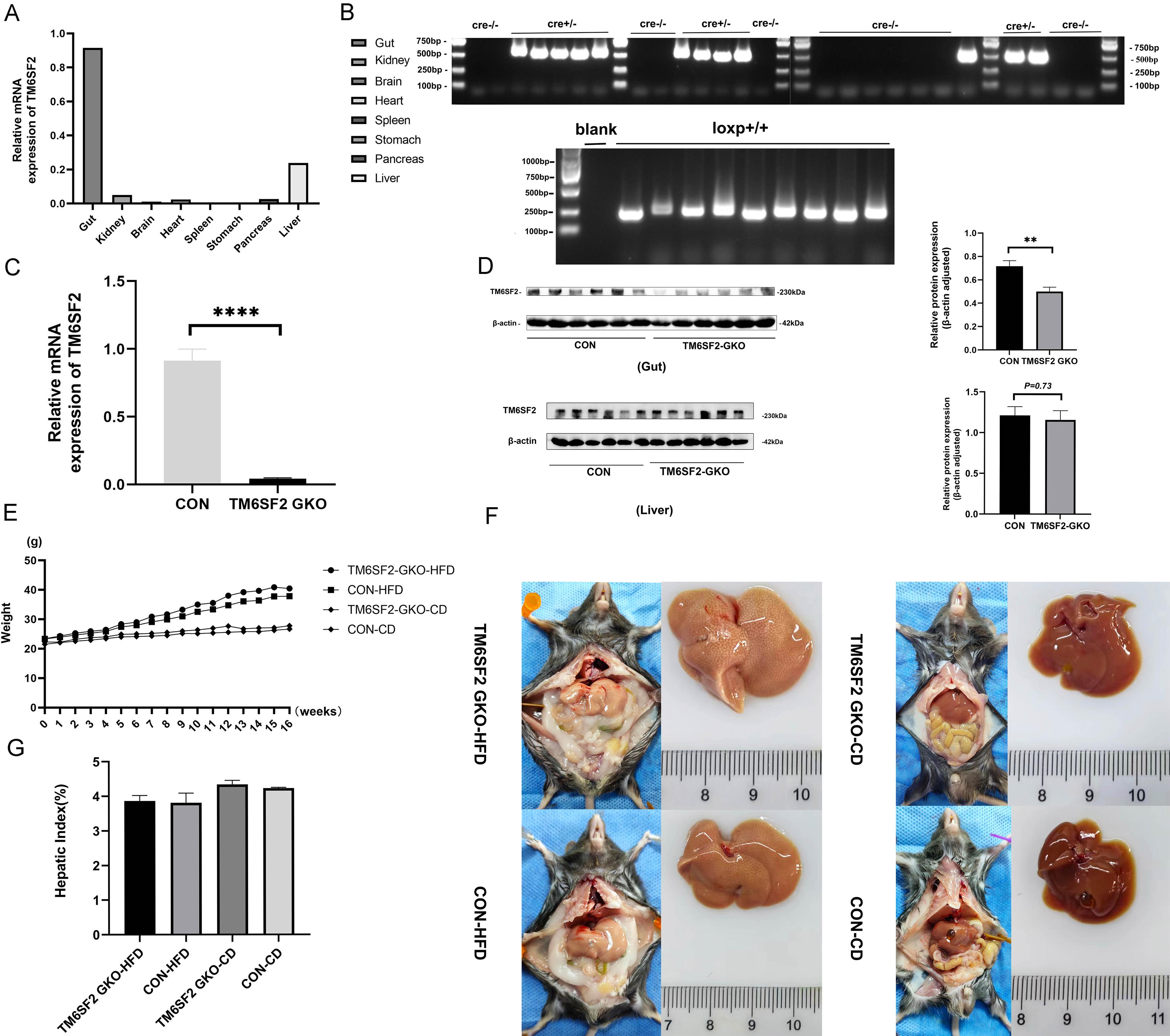 Establishment and general effects of TM6SF2 gut-specific knockout.