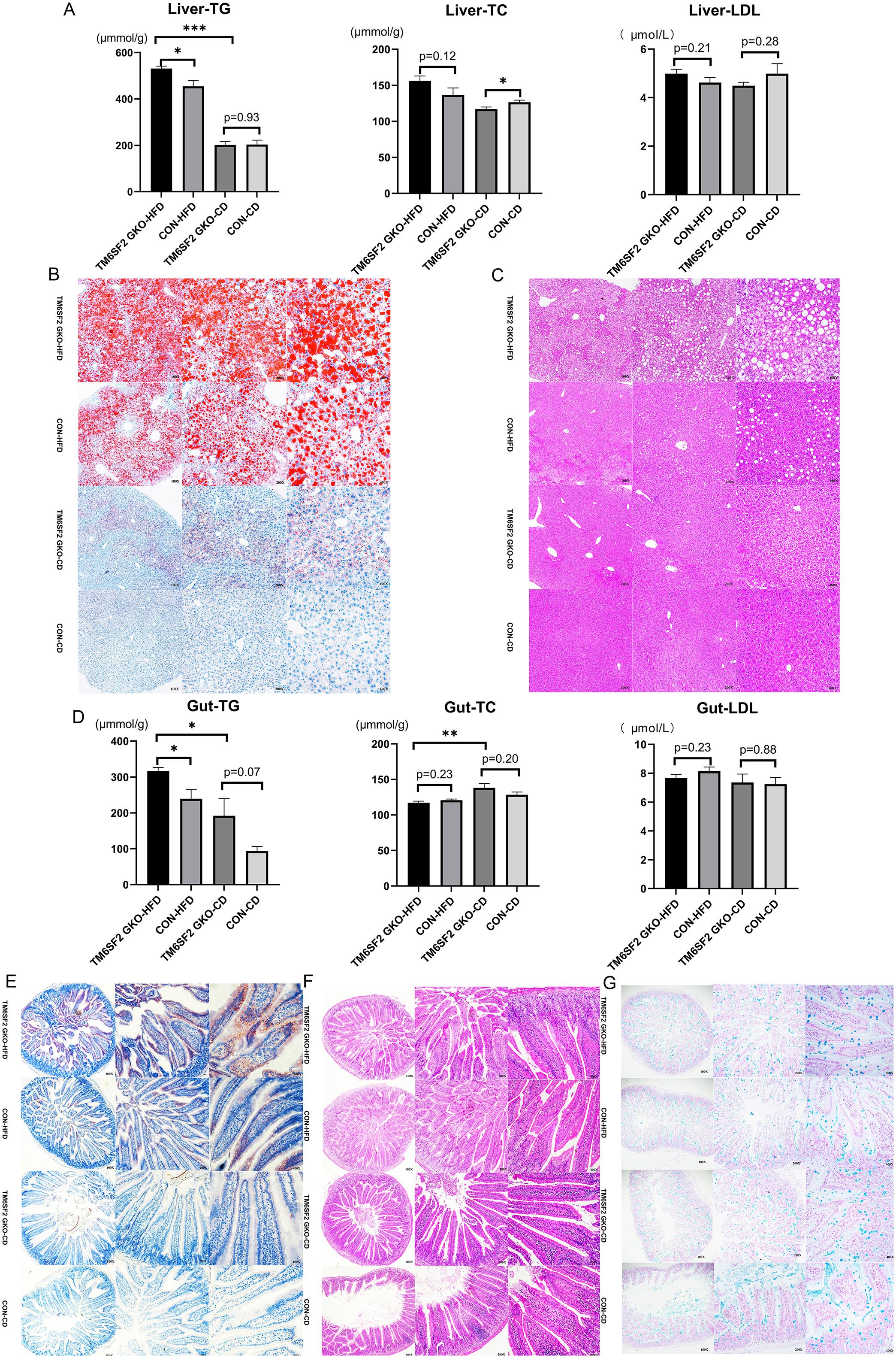 Effects of TM6SF2 gut-specific knockout on the liver and gut.