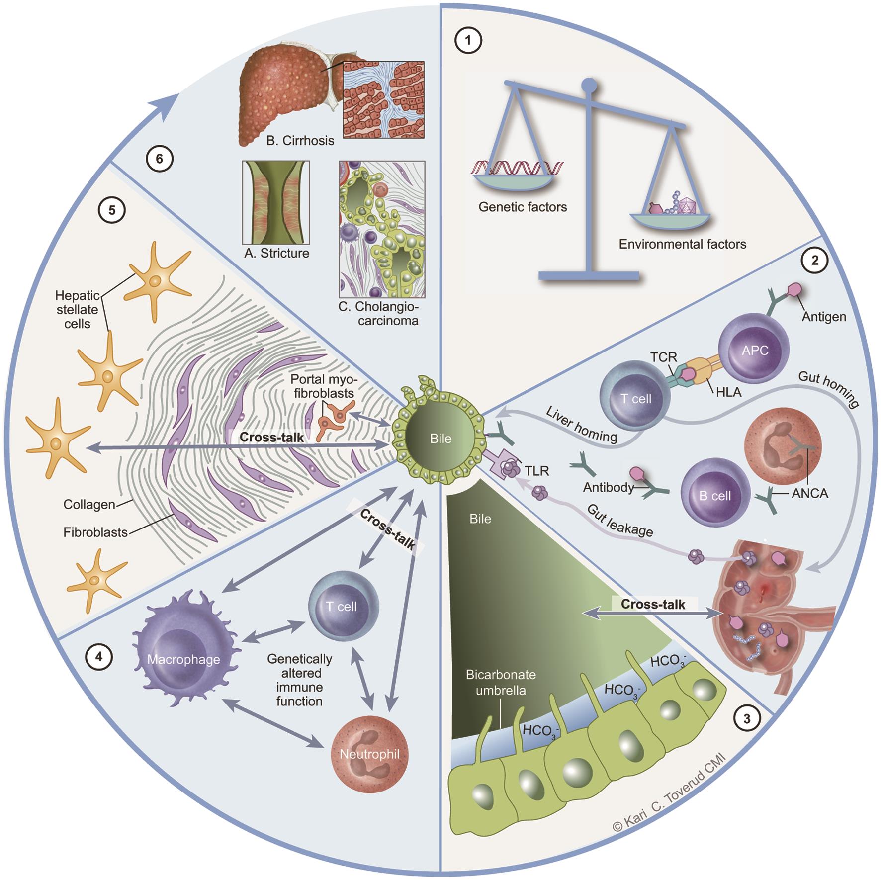 Current Therapeutics in Primary Sclerosing Cholangitis