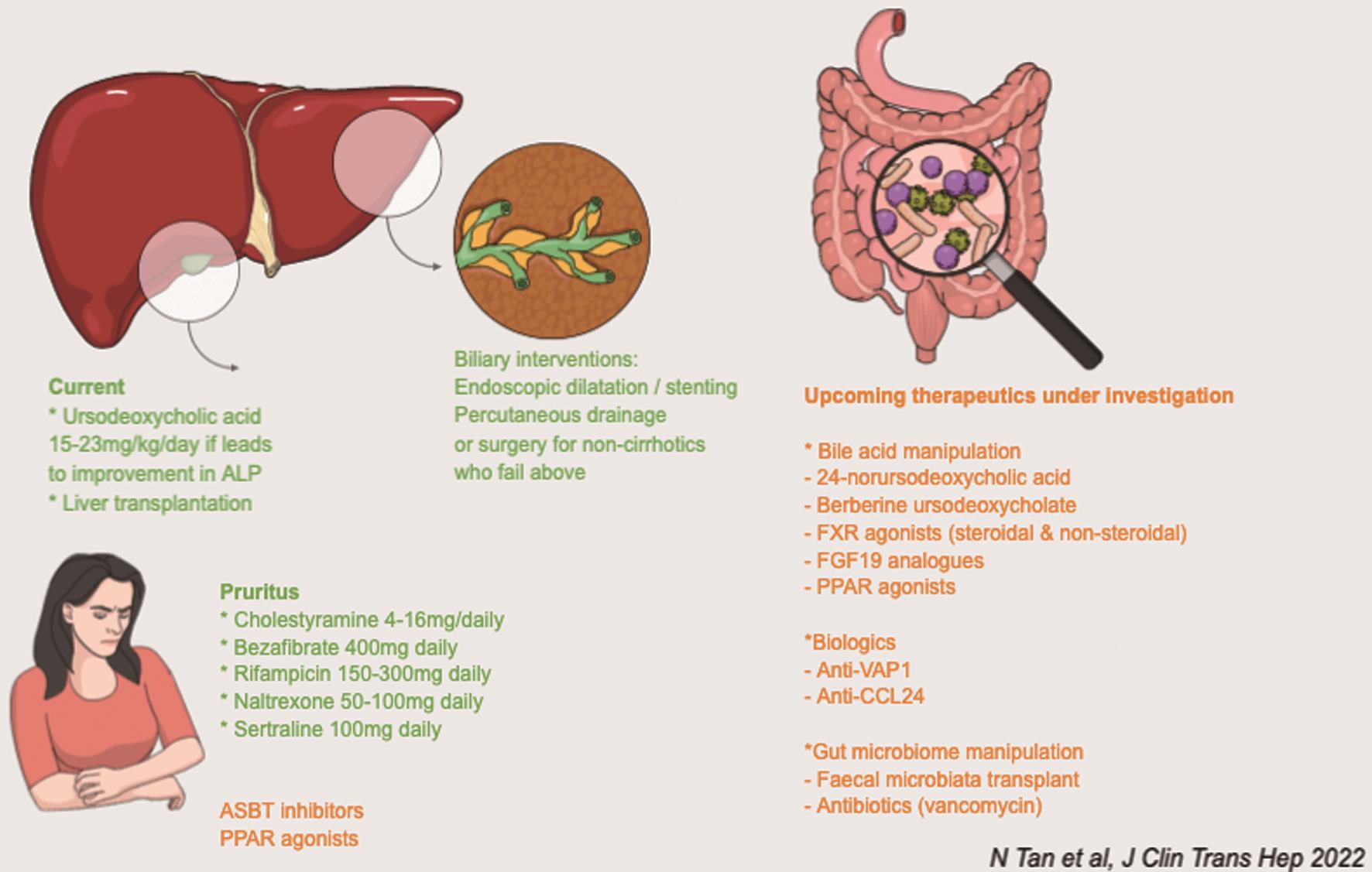 Current Therapeutics in Primary Sclerosing Cholangitis