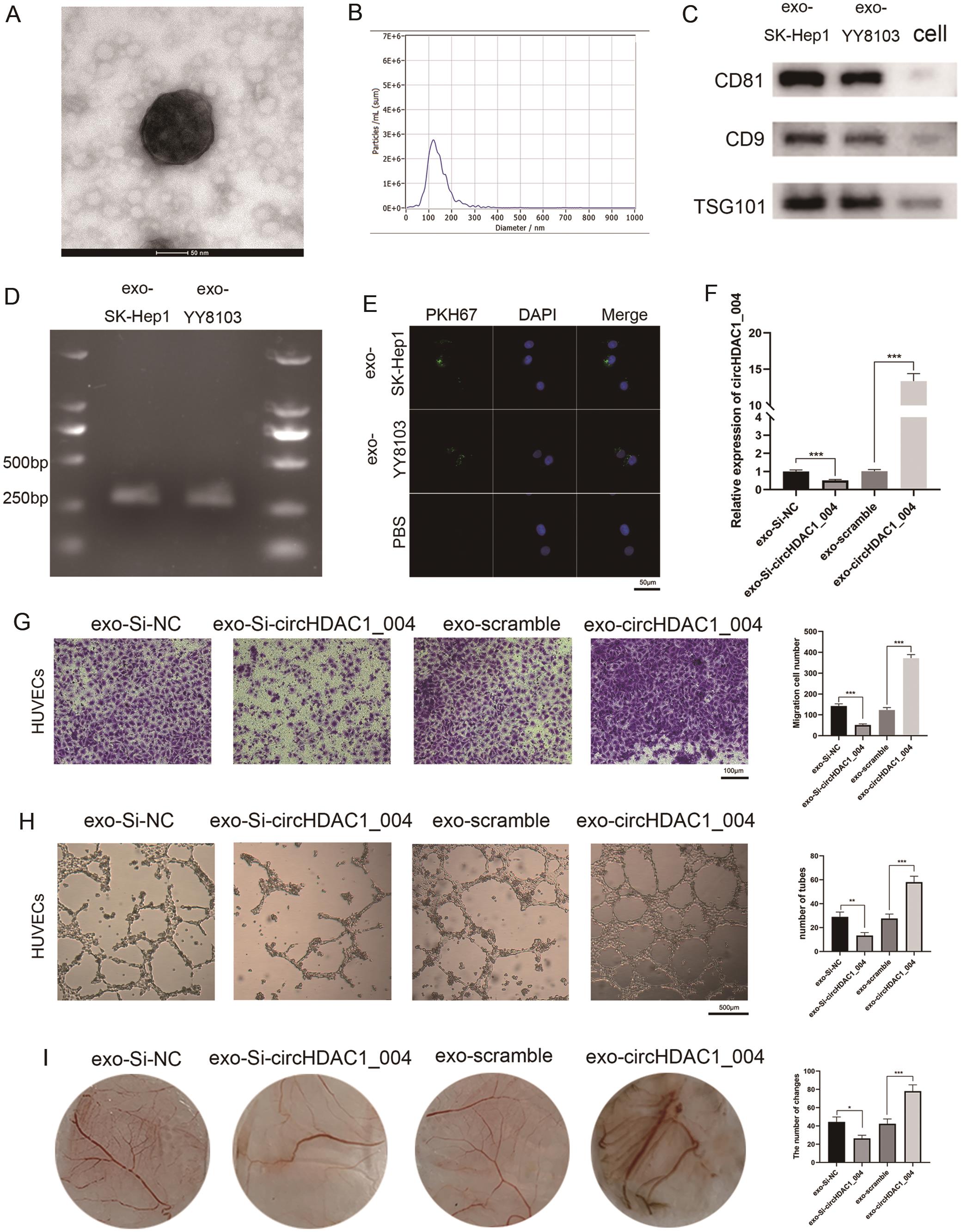 Exosomal circHDAC1_004 promoted the proliferation, migration, and tube formation of HUVECs.