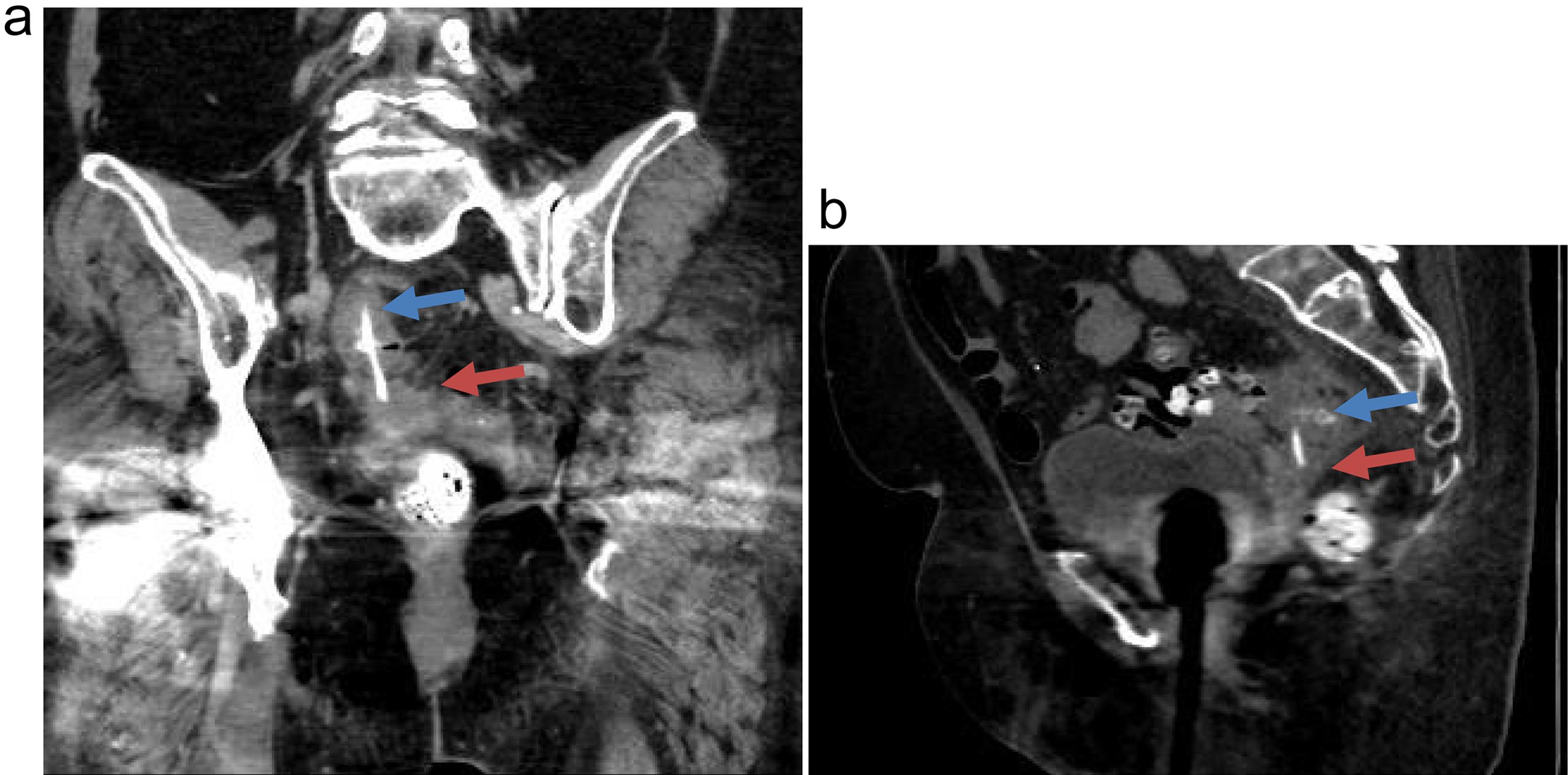 CT scan images.