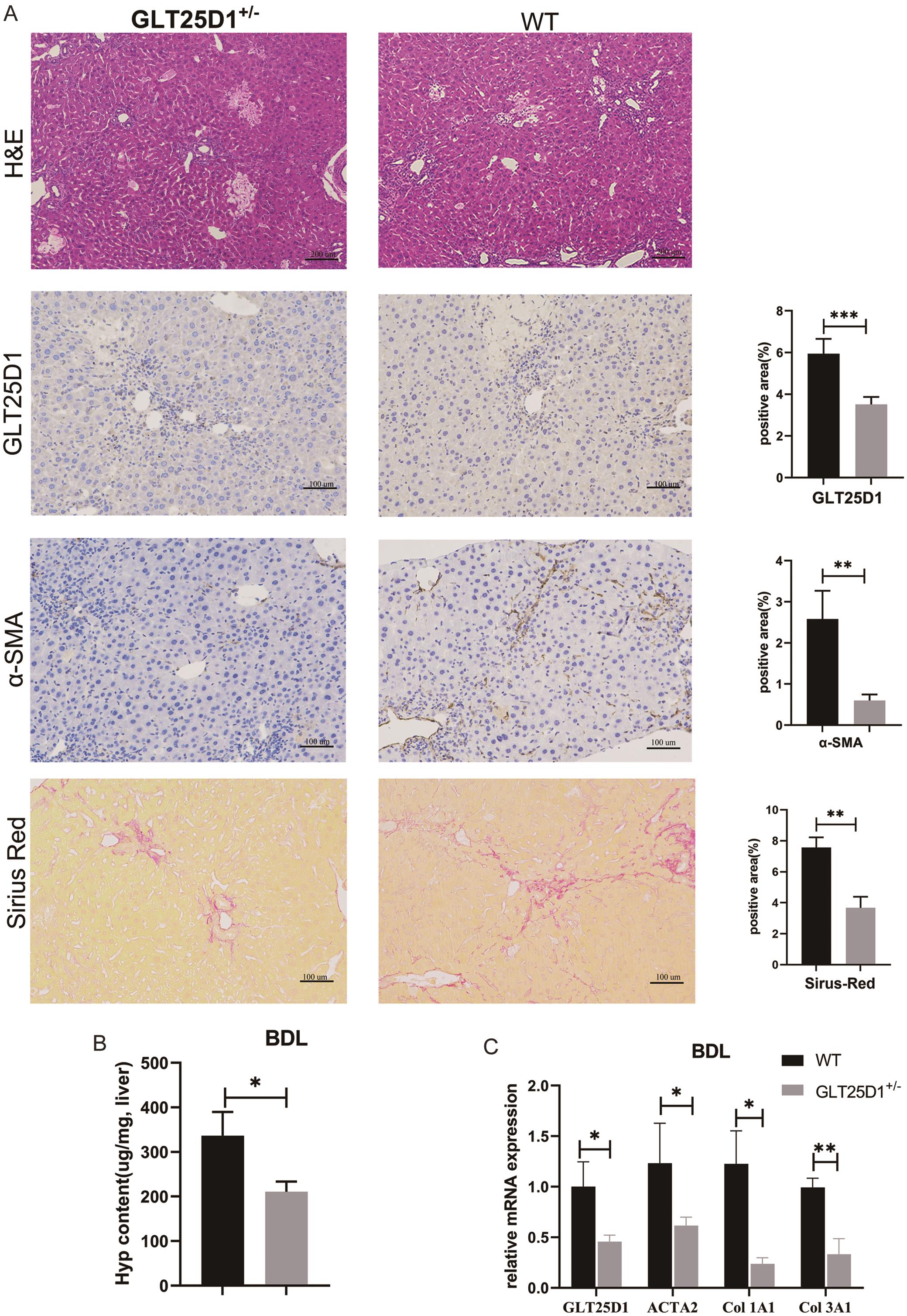 GLT25D1 downregulation attenuates Bile duct ligation (BLD) -induced liver fibrosis.