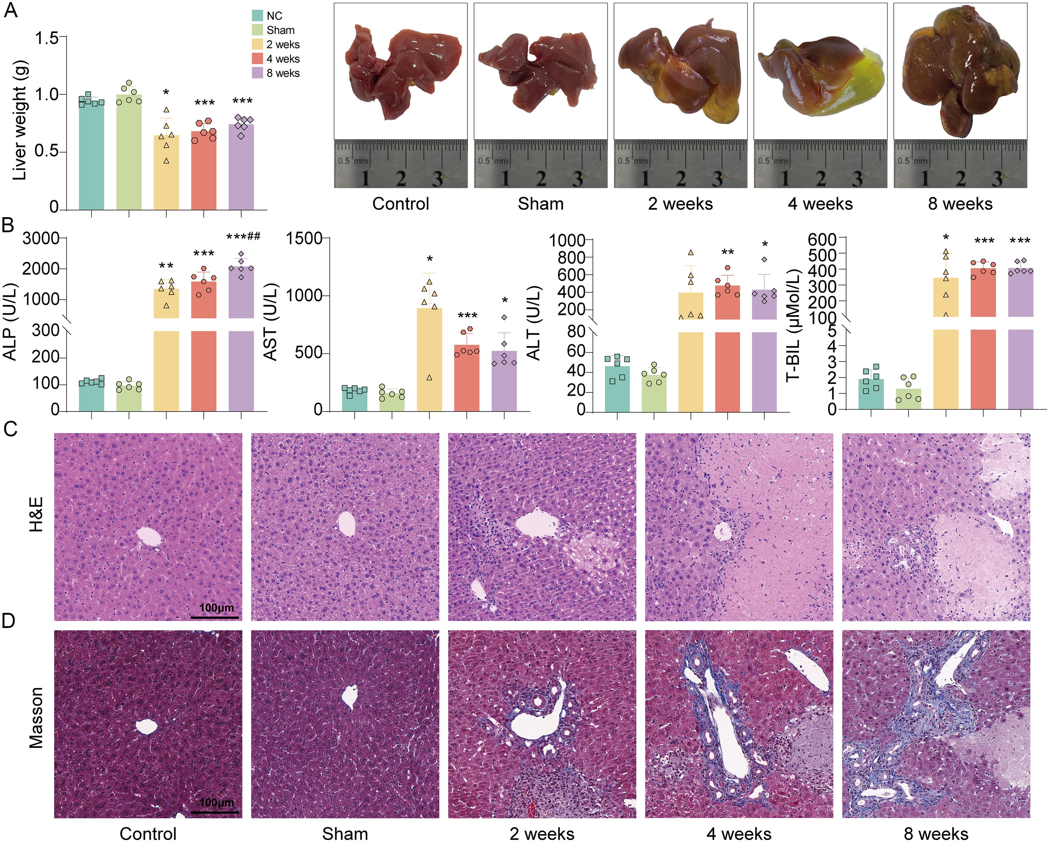 Dynamic effects of bile duct ligation on bile duct response and liver injury in mice.