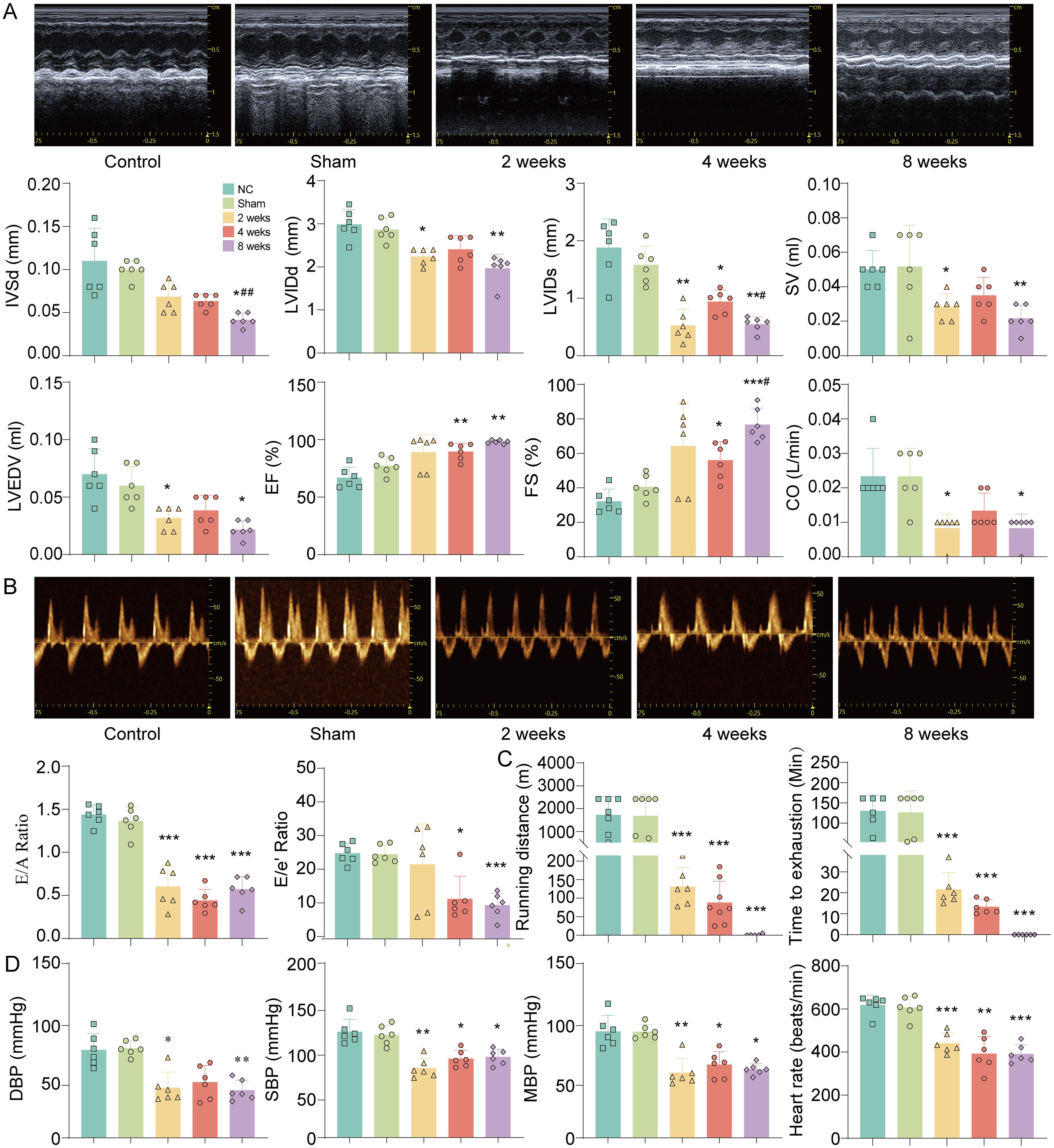 Dynamic effects of bile duct ligation on cardiac function and exercise performance in mice.