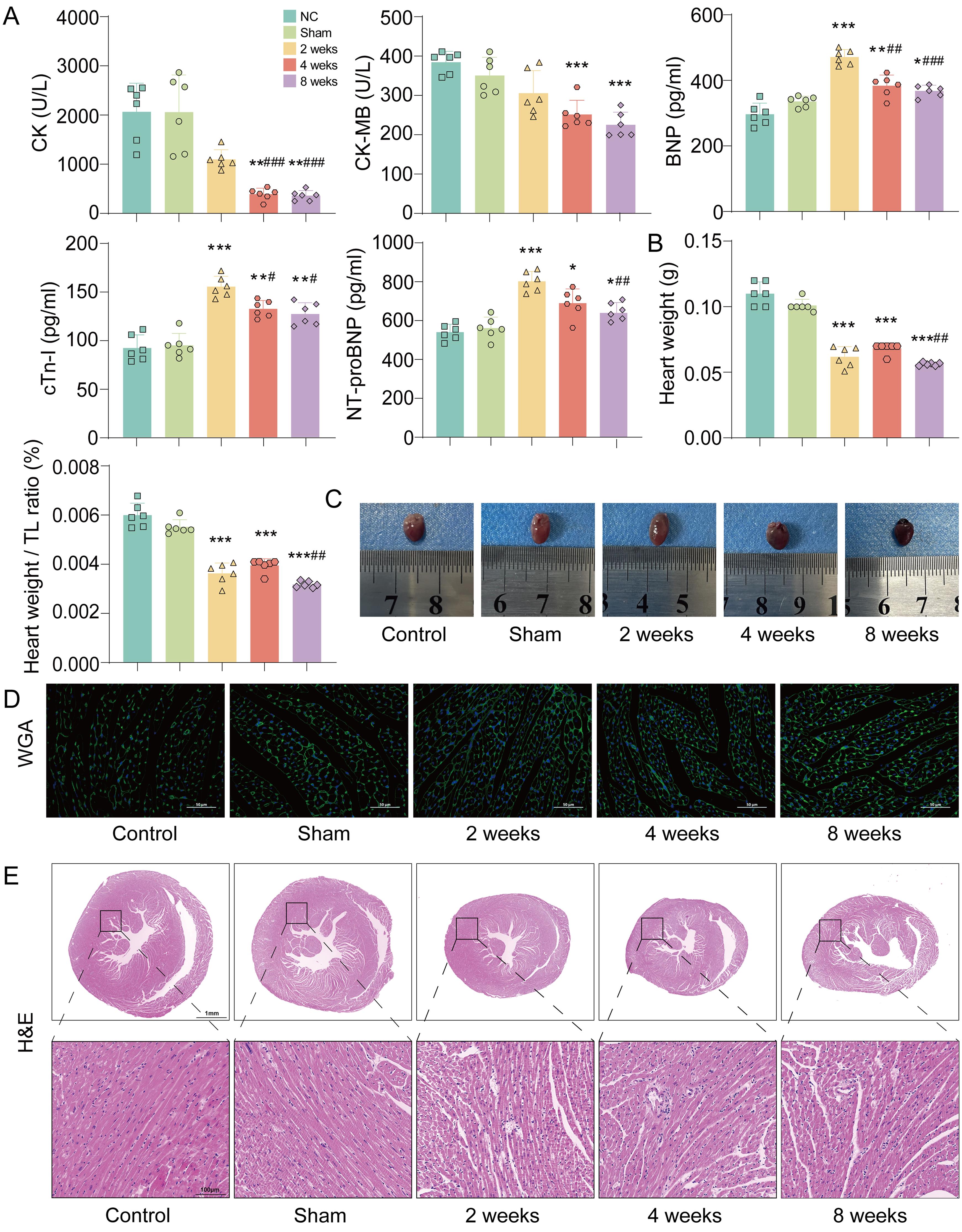 Dynamic effects of bile duct ligation on heart weight, cardiomyocyte morphology, and ventricular remodeling in mice.
