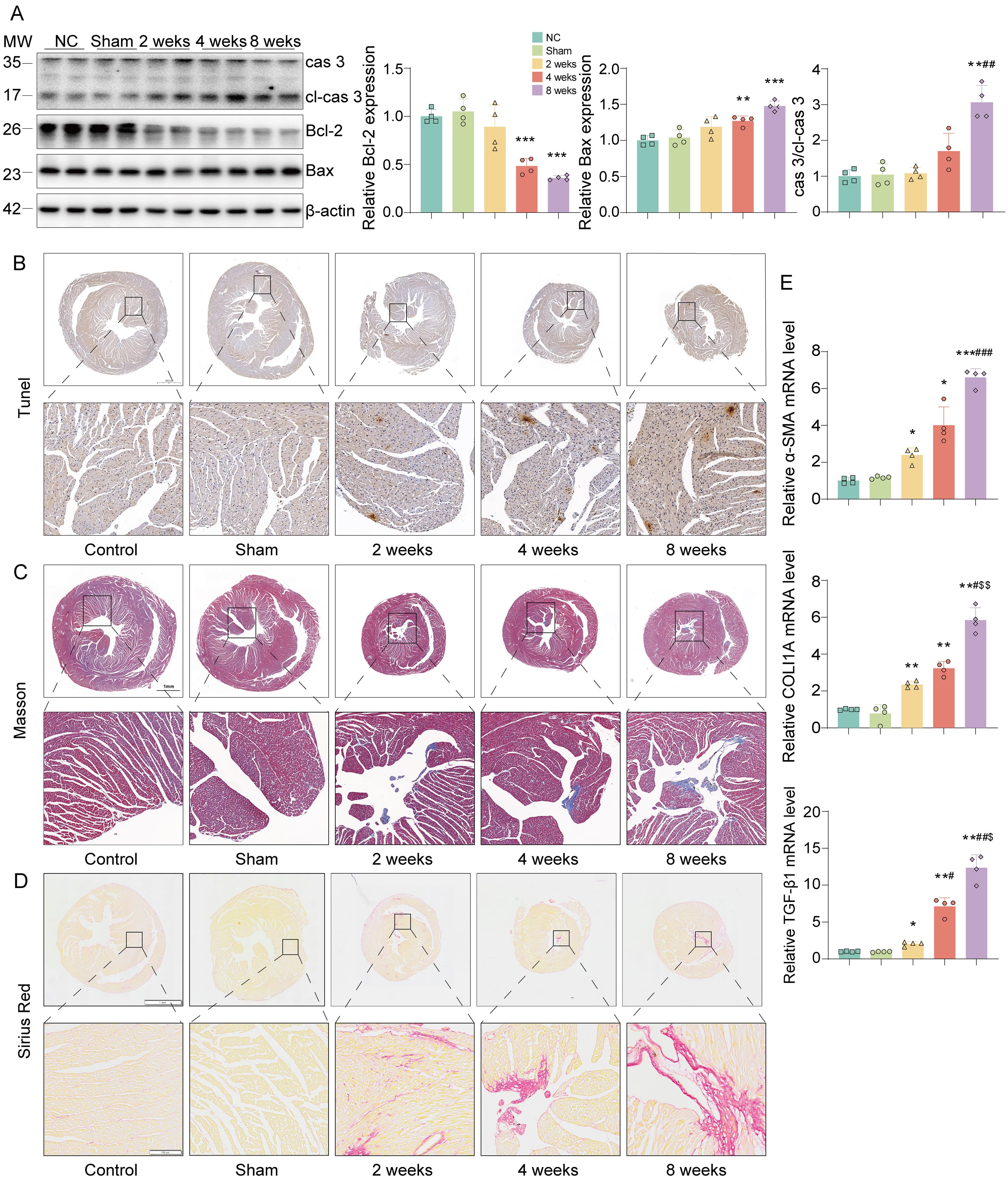 Dynamic effects of bile duct ligation on myocardial injury, apoptosis, and fibrosis in mice.