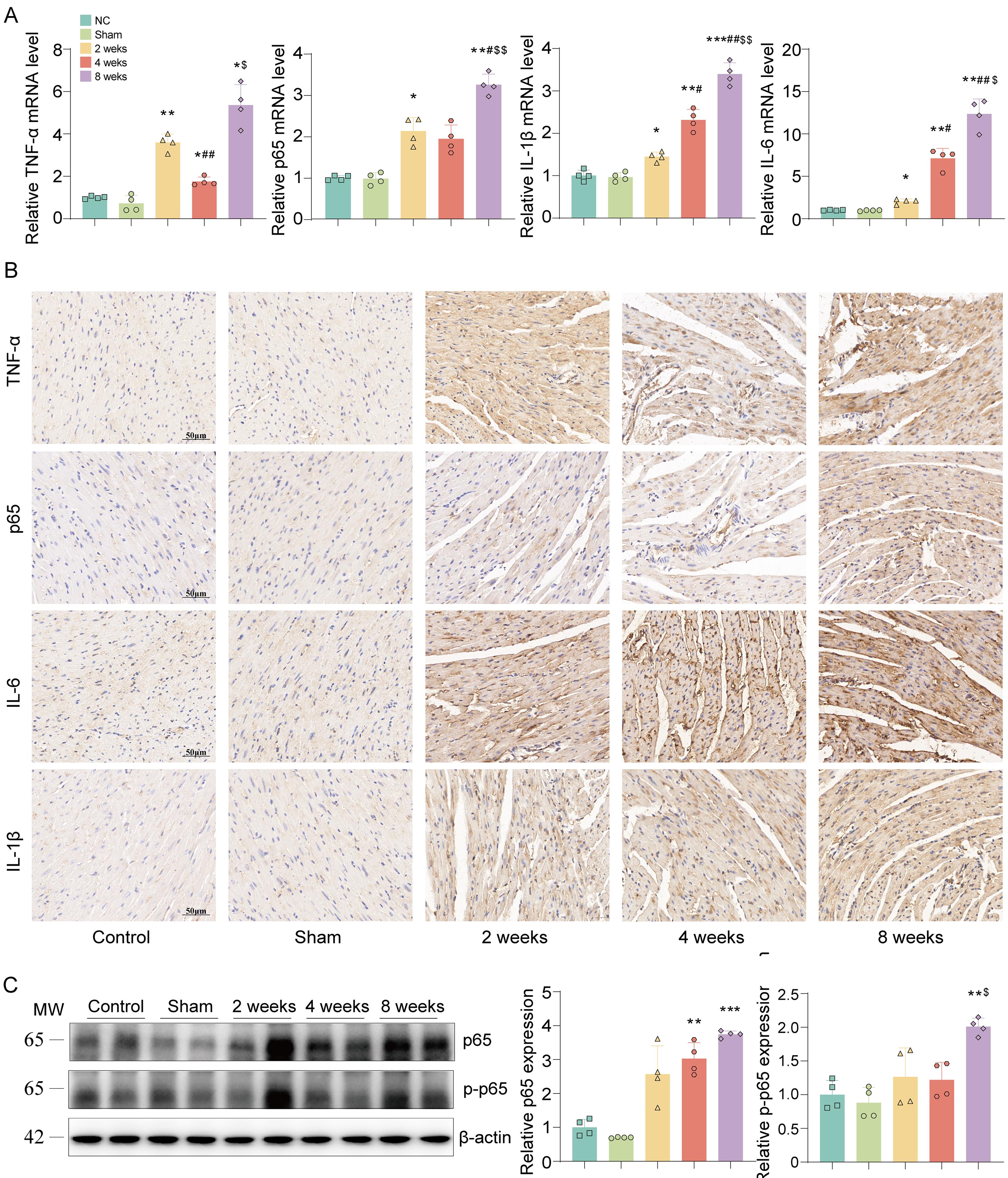Dynamic effects of bile duct ligation on myocardial inflammation in mouse hearts.