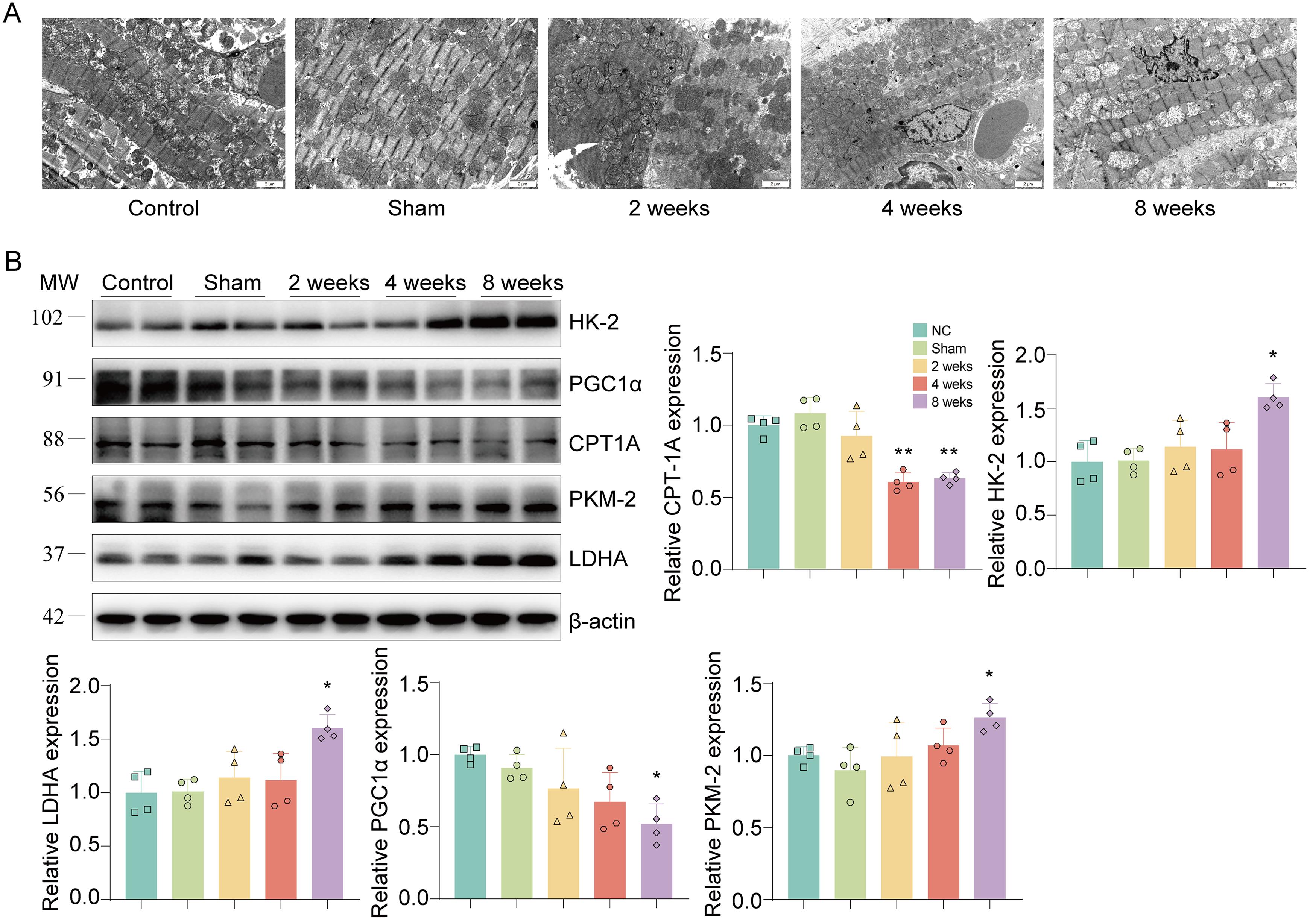 Dynamic effects of bile duct ligation on mitochondrial injury and autophagy in mouse hearts.