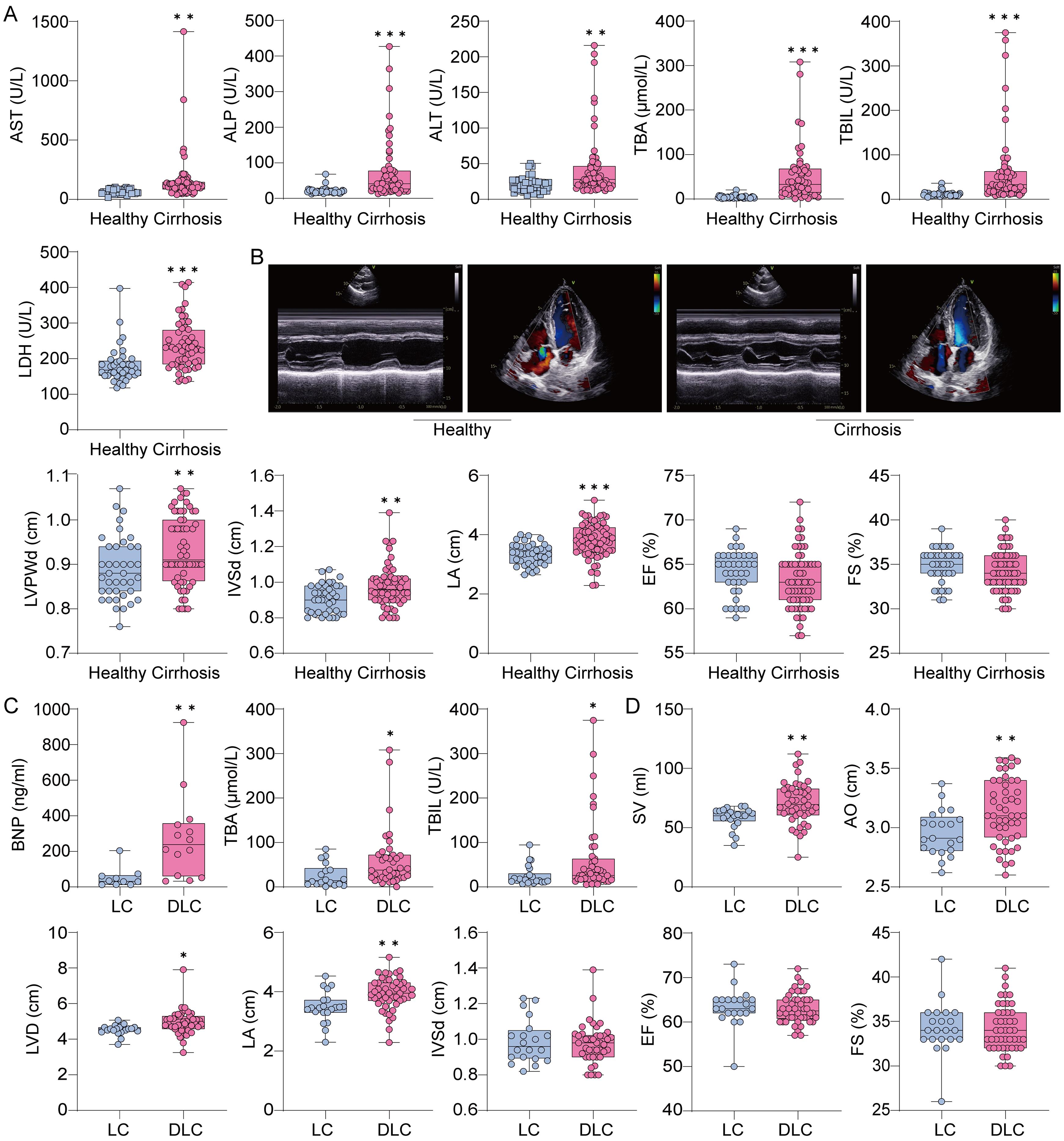 Cardiac dysfunction in patients with cirrhosis.