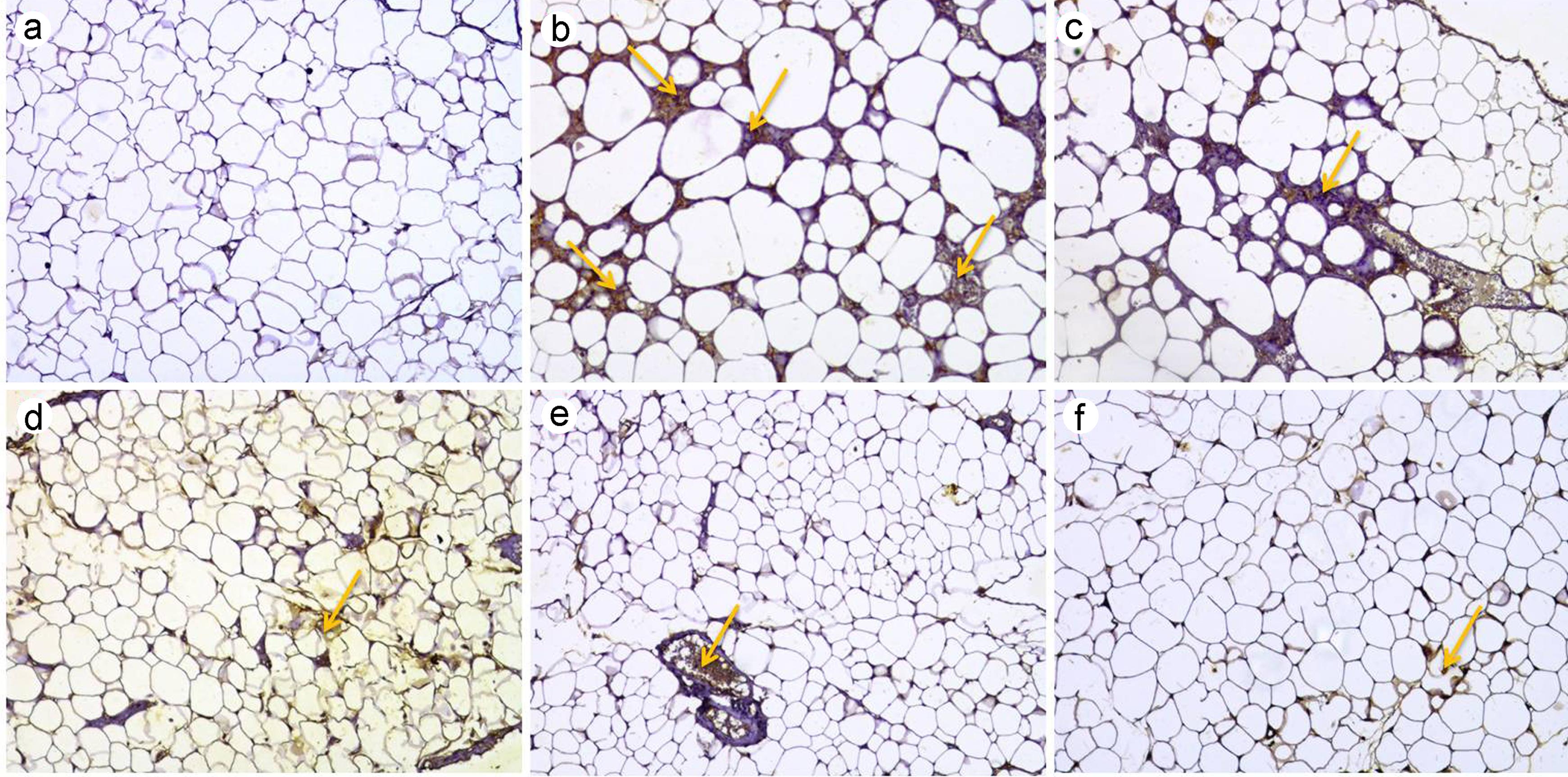 Effect of MD-1 on TNF-α infiltration in epididymal fat pads.