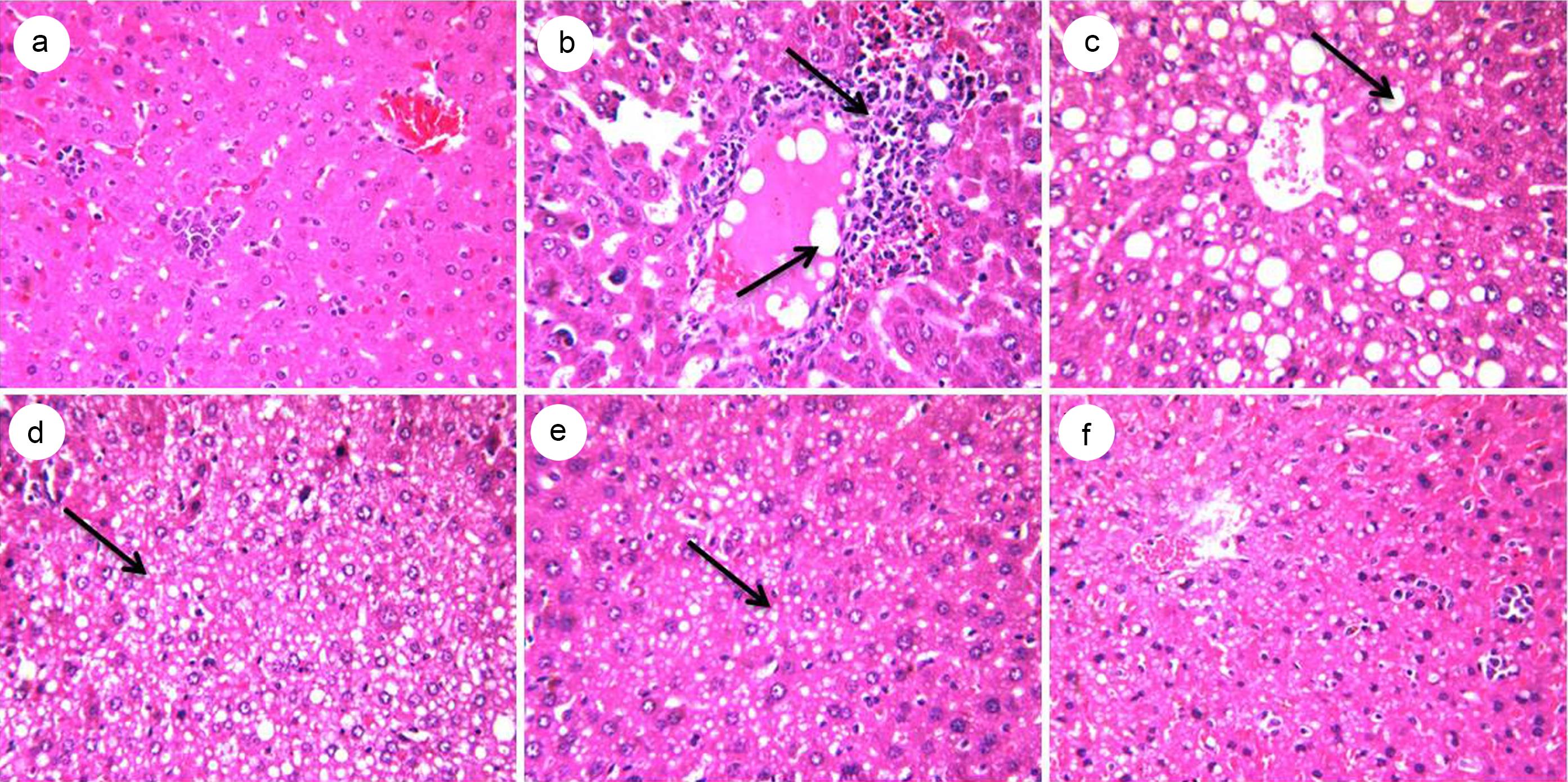 Effect of MD-1 on hepatic steatosis.