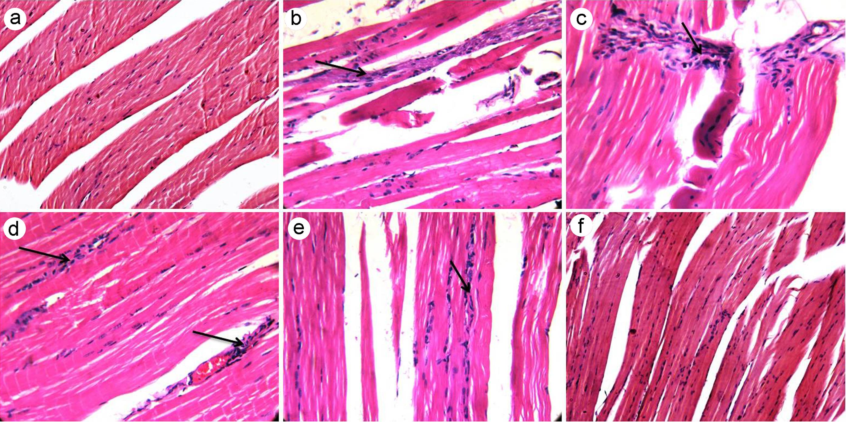 Effect of MD-1 on skeletal muscle.
