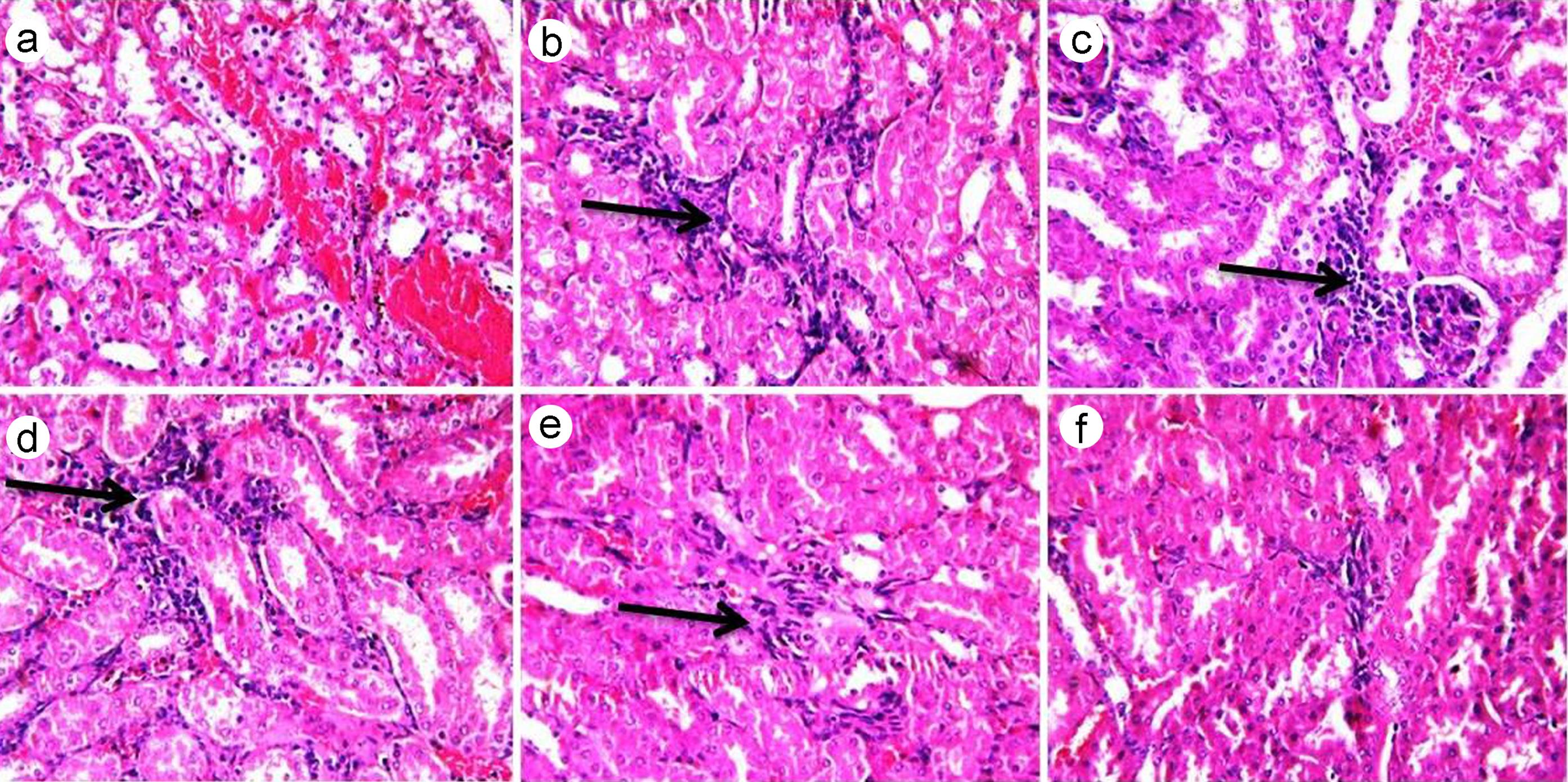 Effect of MD-1 on the Kidney tissue.