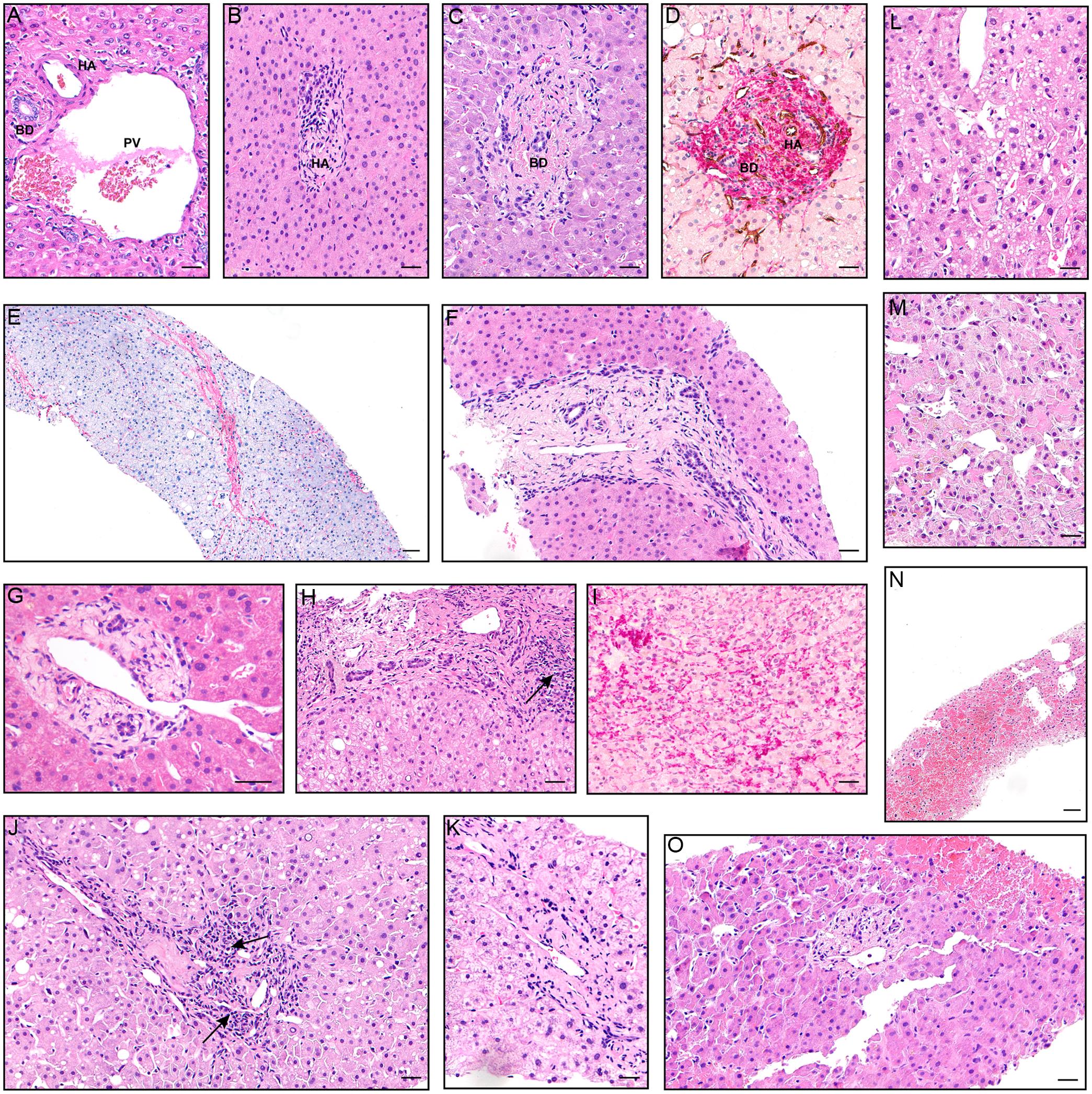 Representative histopathological images during PA-induced liver injury.