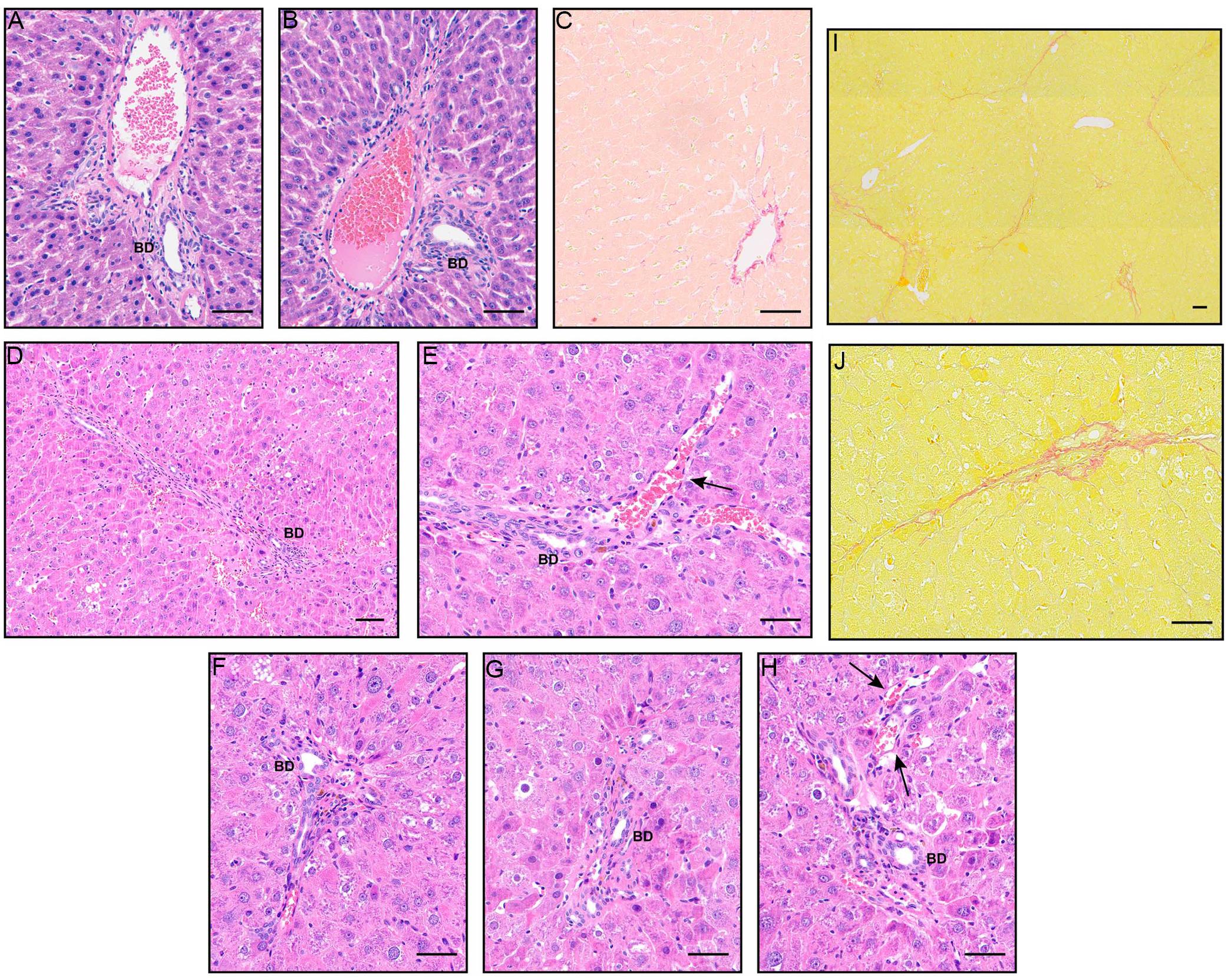 Main histological alterations observed in MCT-induced SOS animal models.