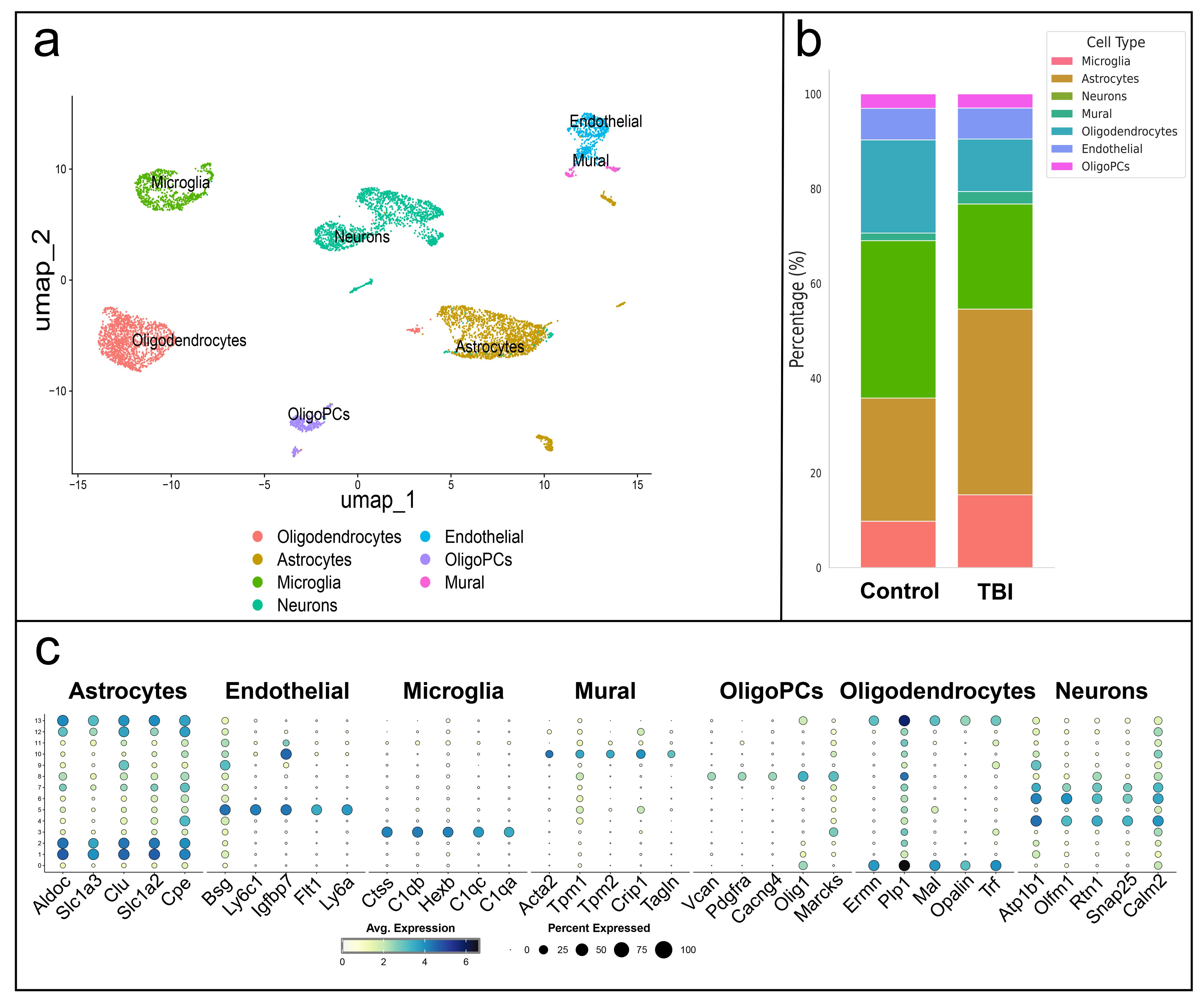 Single-cell analysis of the cell-type proportions after TBI.