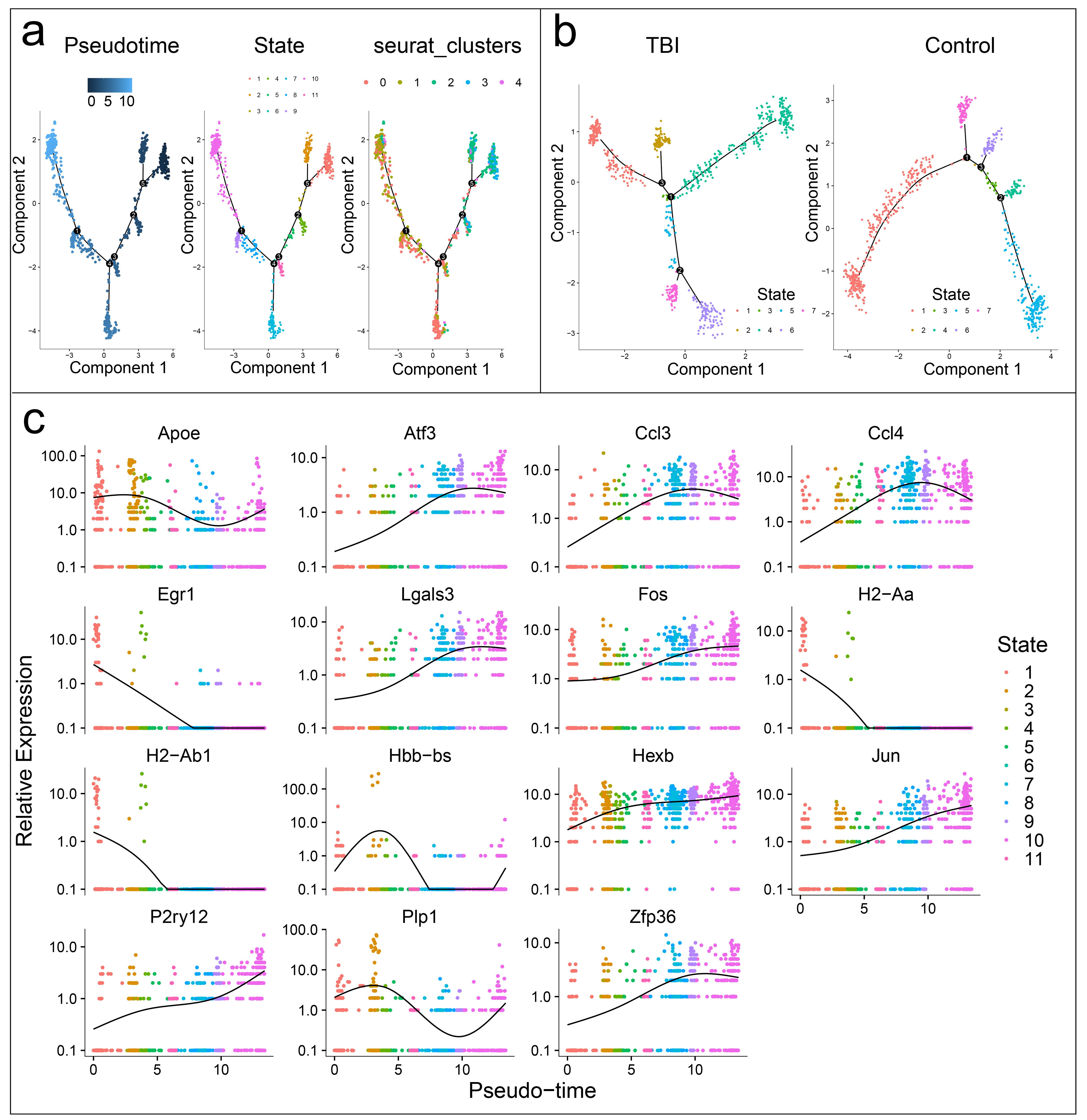 Pseudotime trajectory analysis of microglial cells.