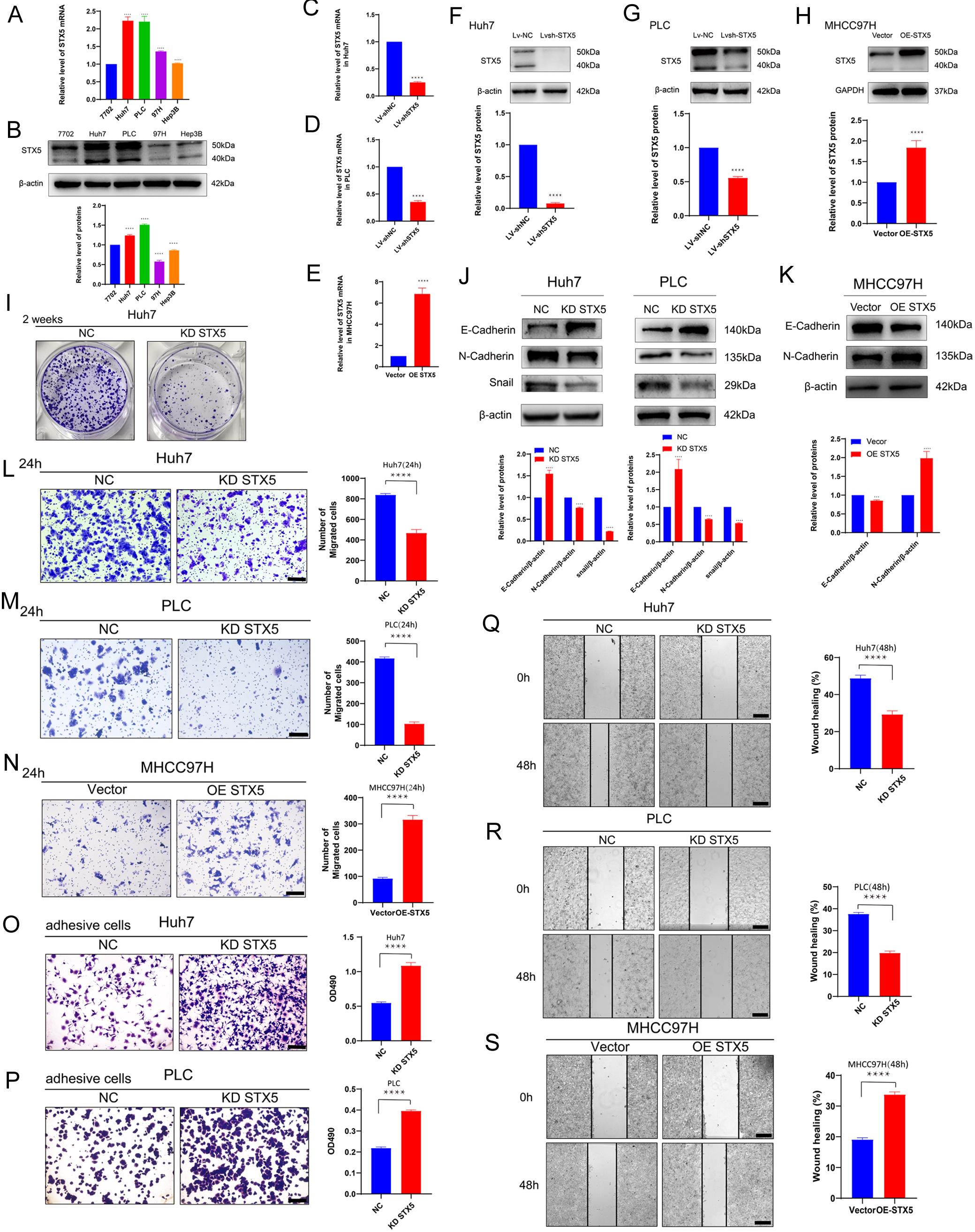 Effects of STX5 expression level on HCC cell migration, adhesion, and EMT.