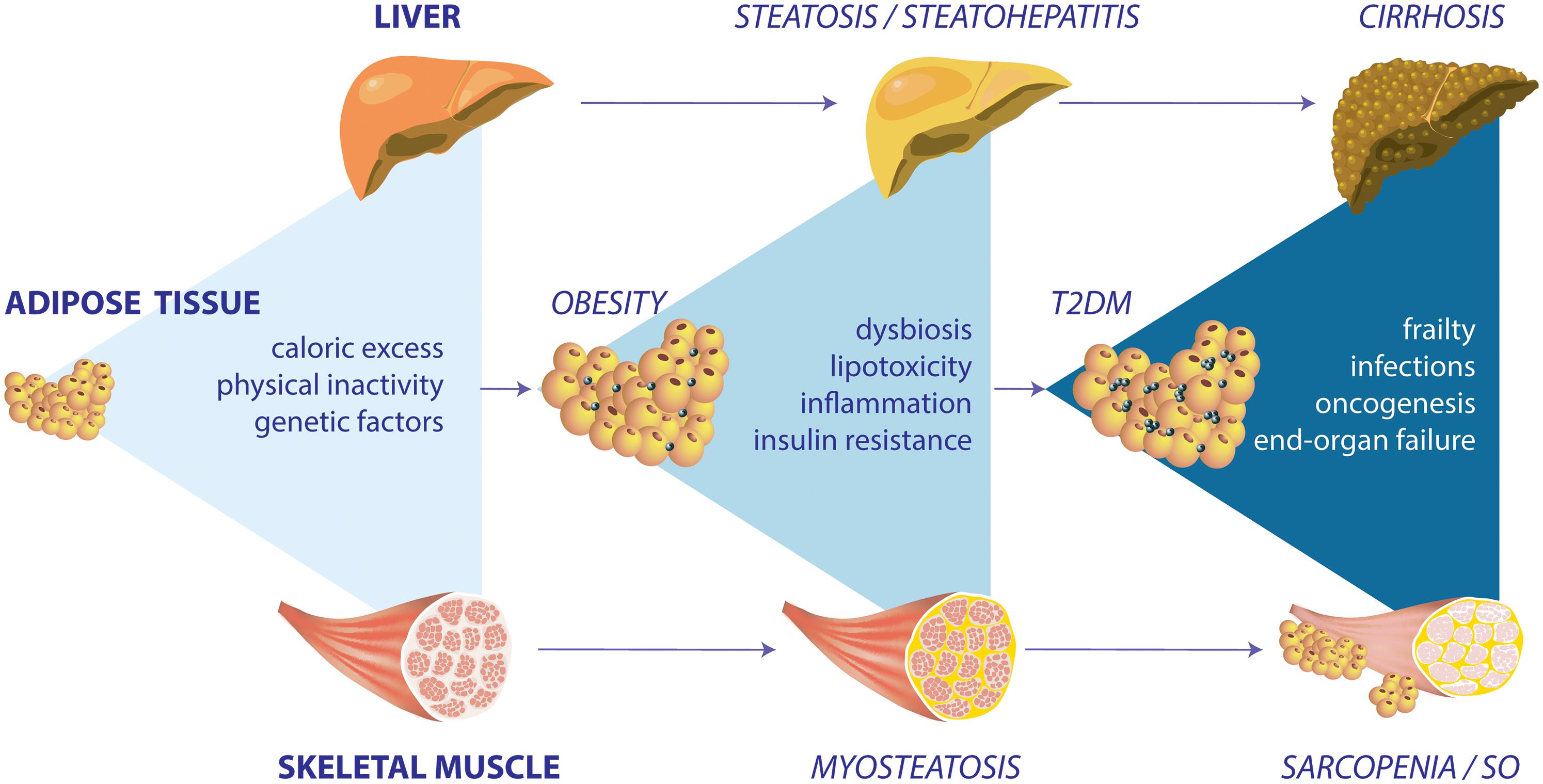 skeletal-muscle-dysfunction-in-the-development-and-progression-of