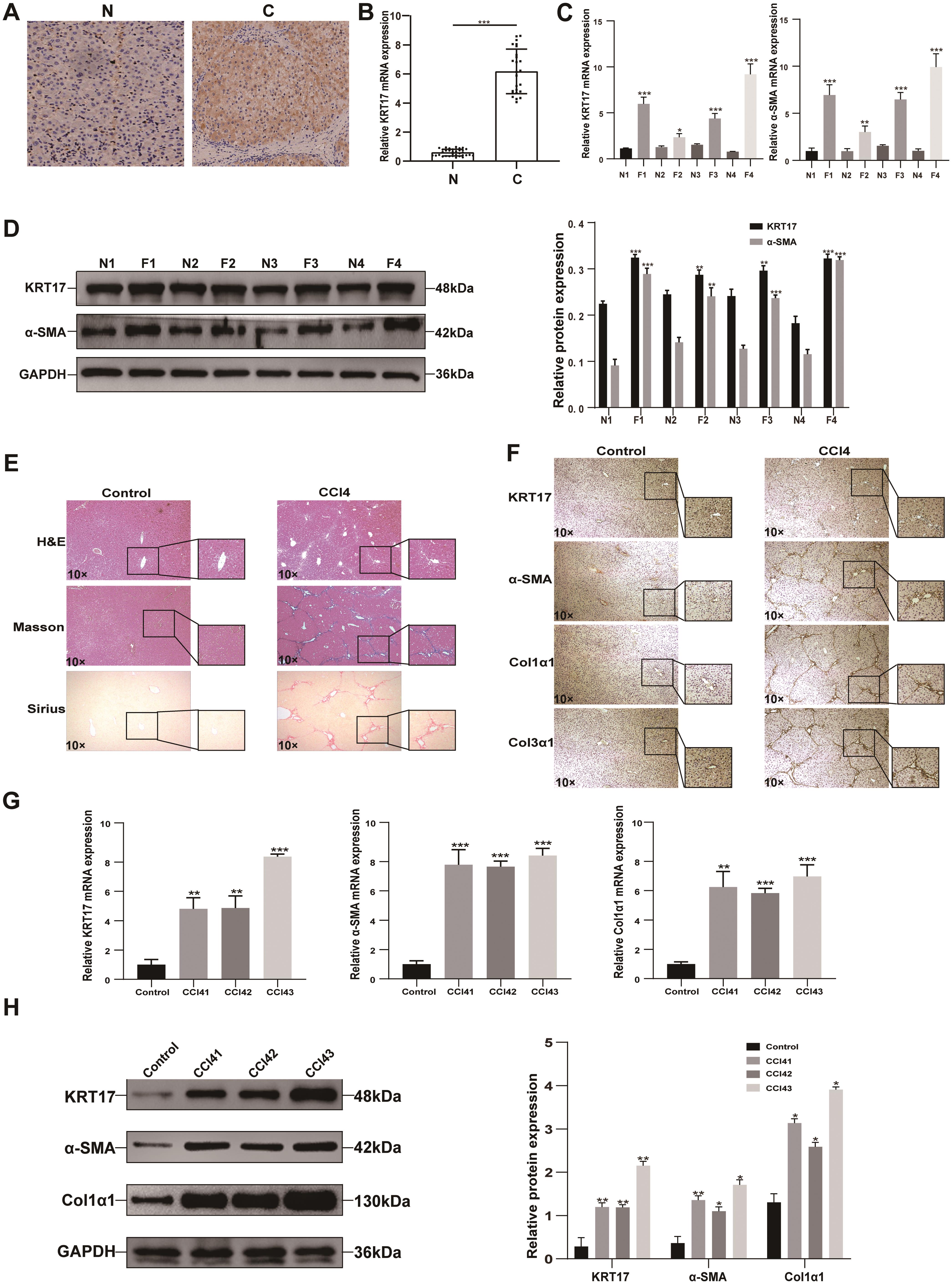 Upregulation of KRT17 in mouse and human fibrotic livers tissues.