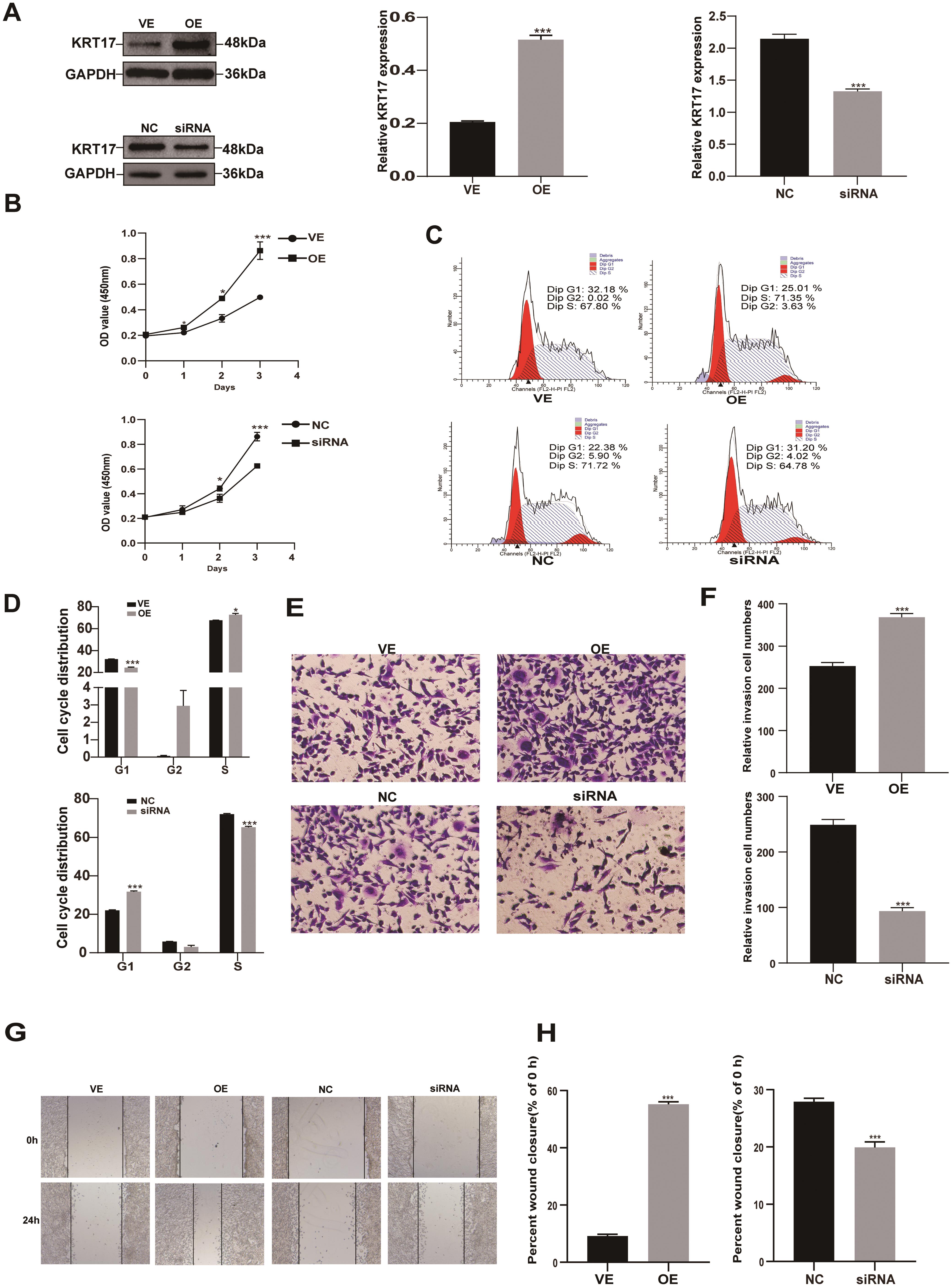 KRT17 induced proliferation and migration in LX-2 cells.