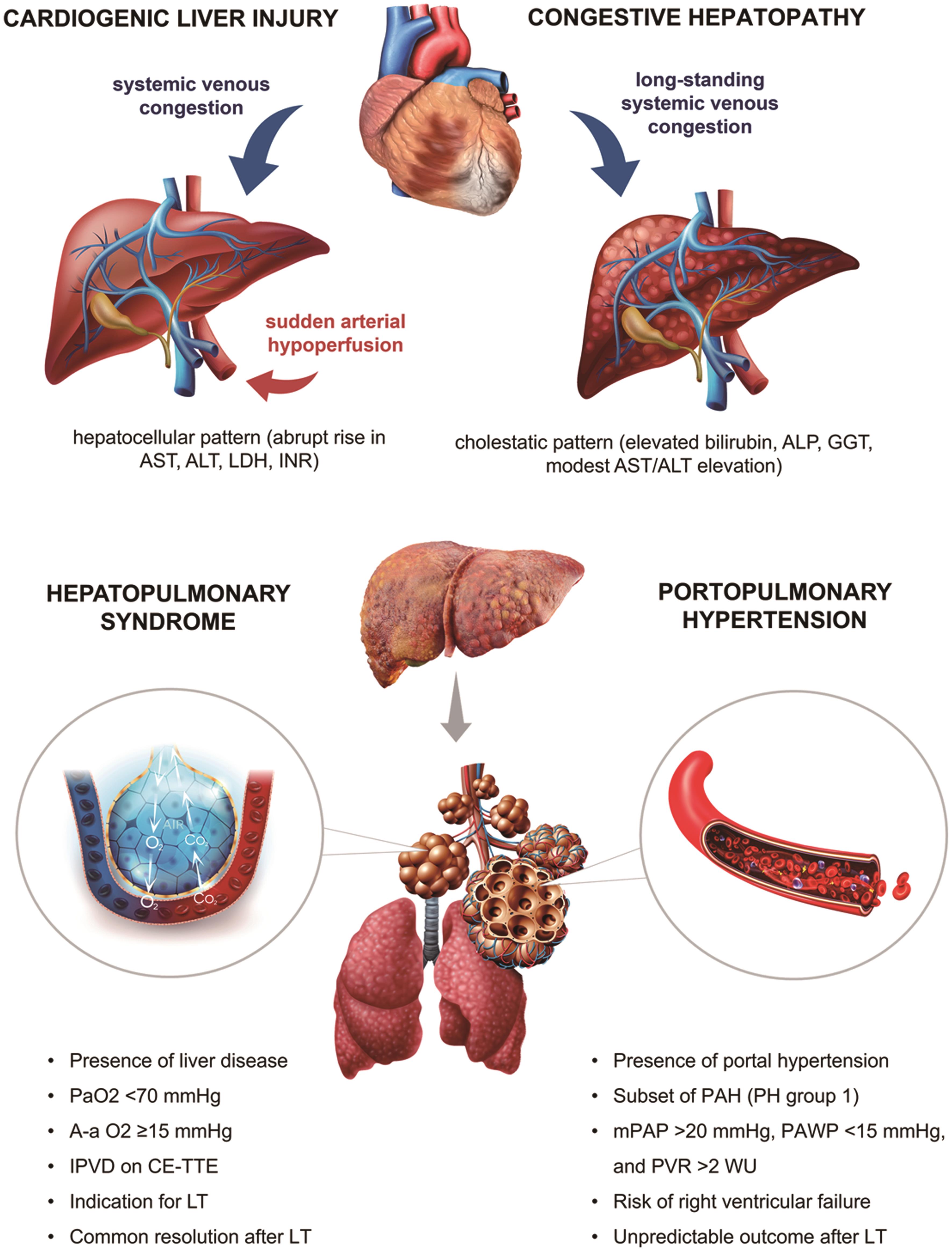 Clinical features of cardiac syndromes in liver disease.