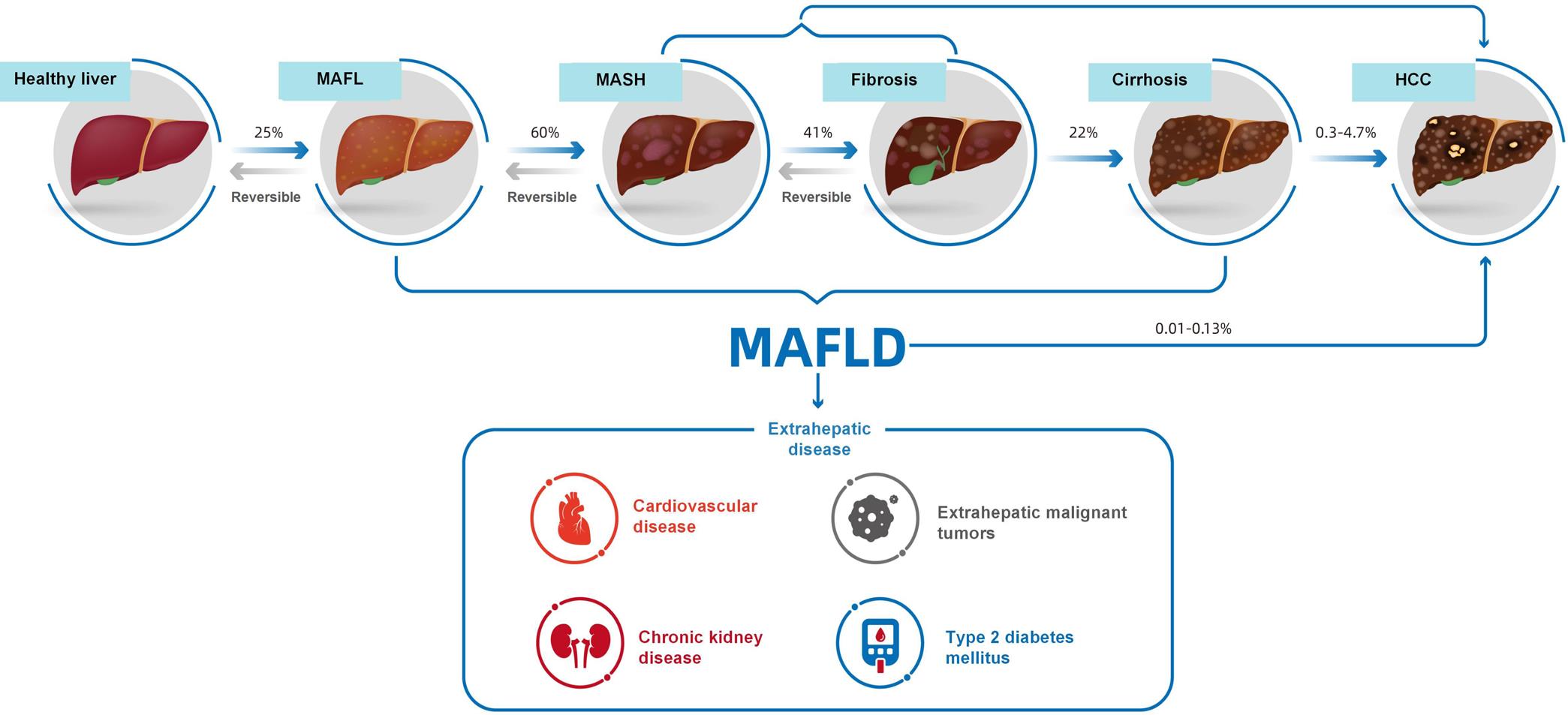The natural history of MAFLD.