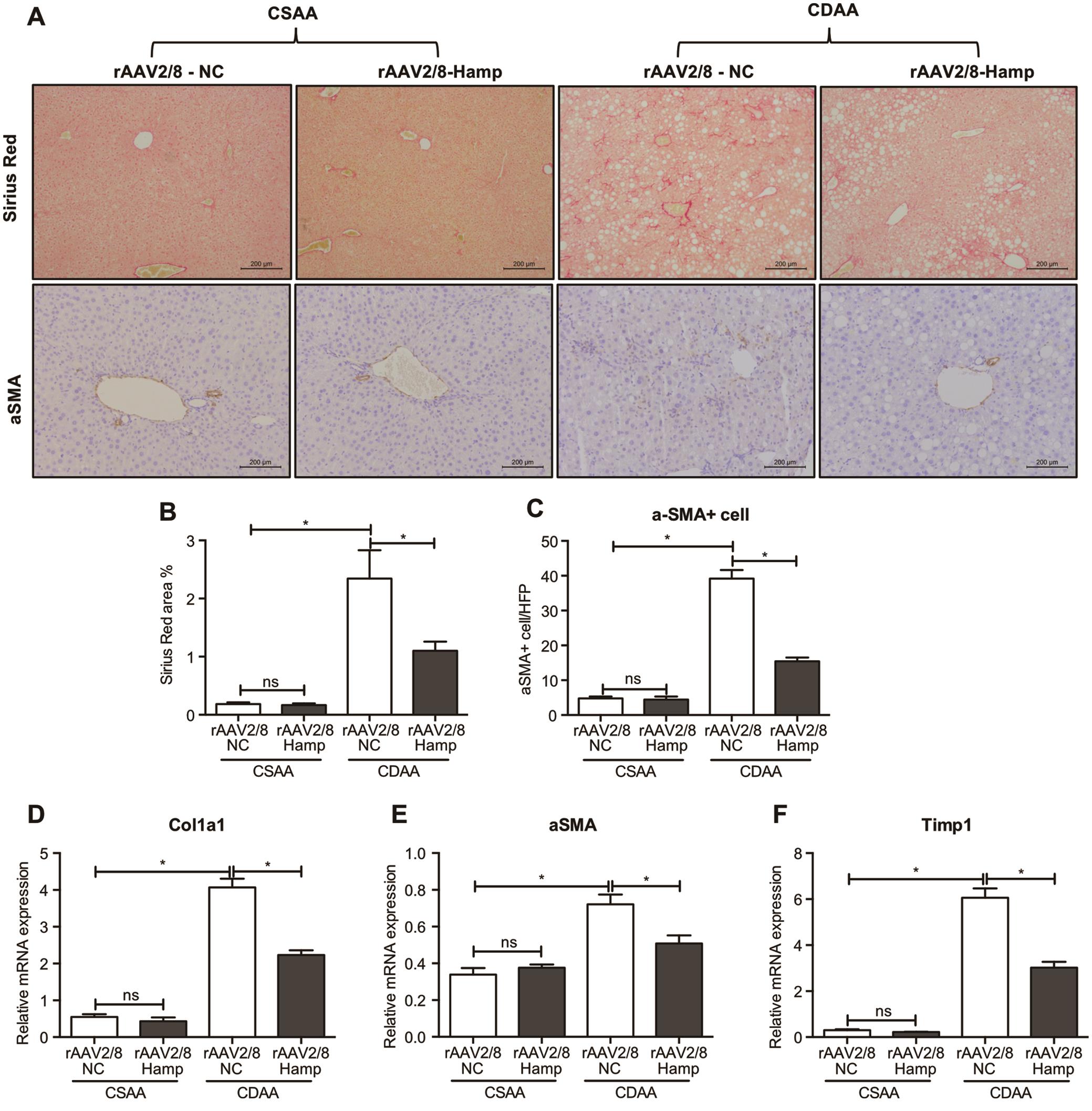 rAAV2/8-Hamp treatment suppressed hepatic fibrosis in mice fed a CDAA diet.
