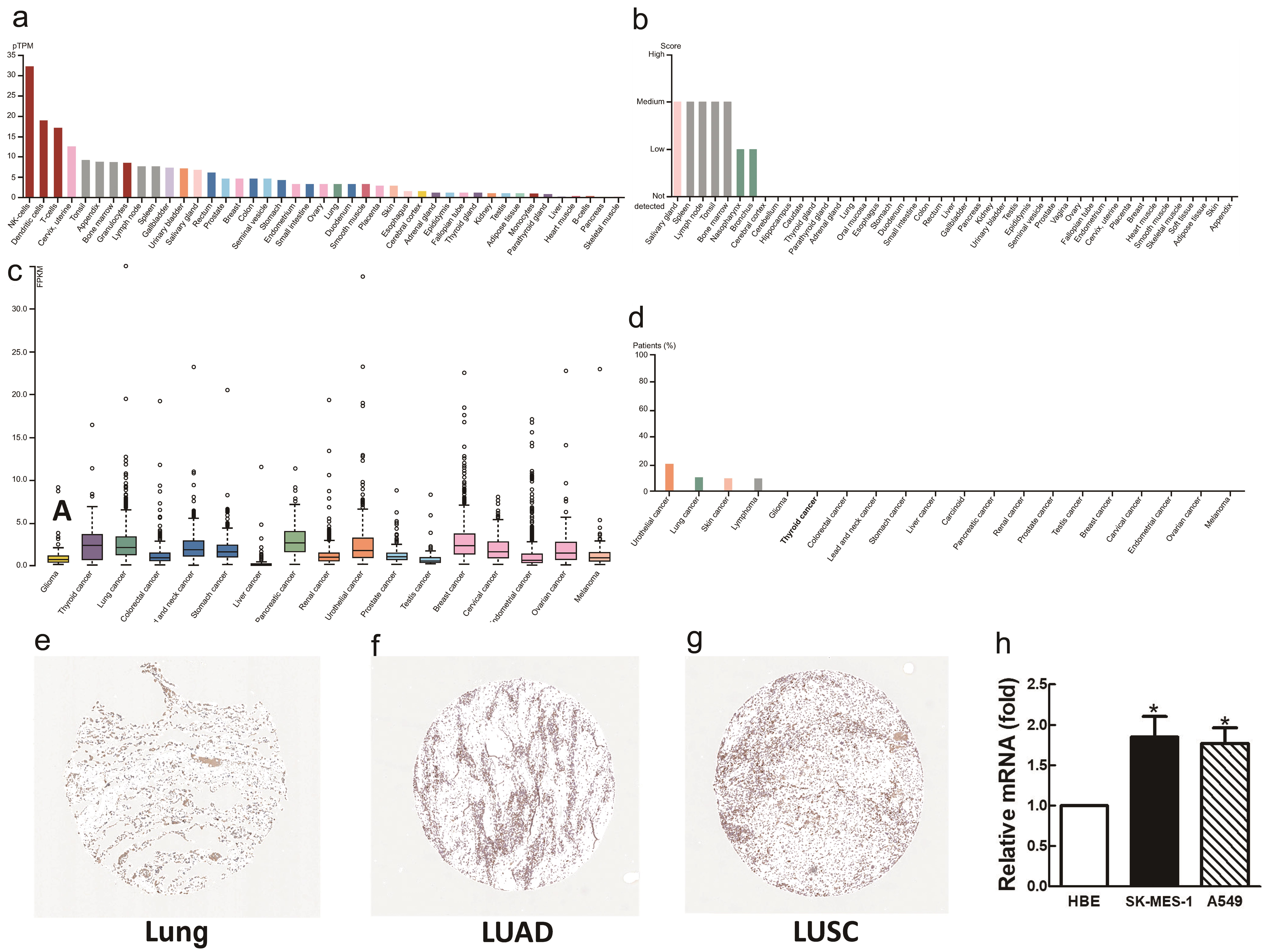 Immunohistochemistry and gene expression of RUNX2 based on the Human Protein Atlas and PT-qPCR experiment.