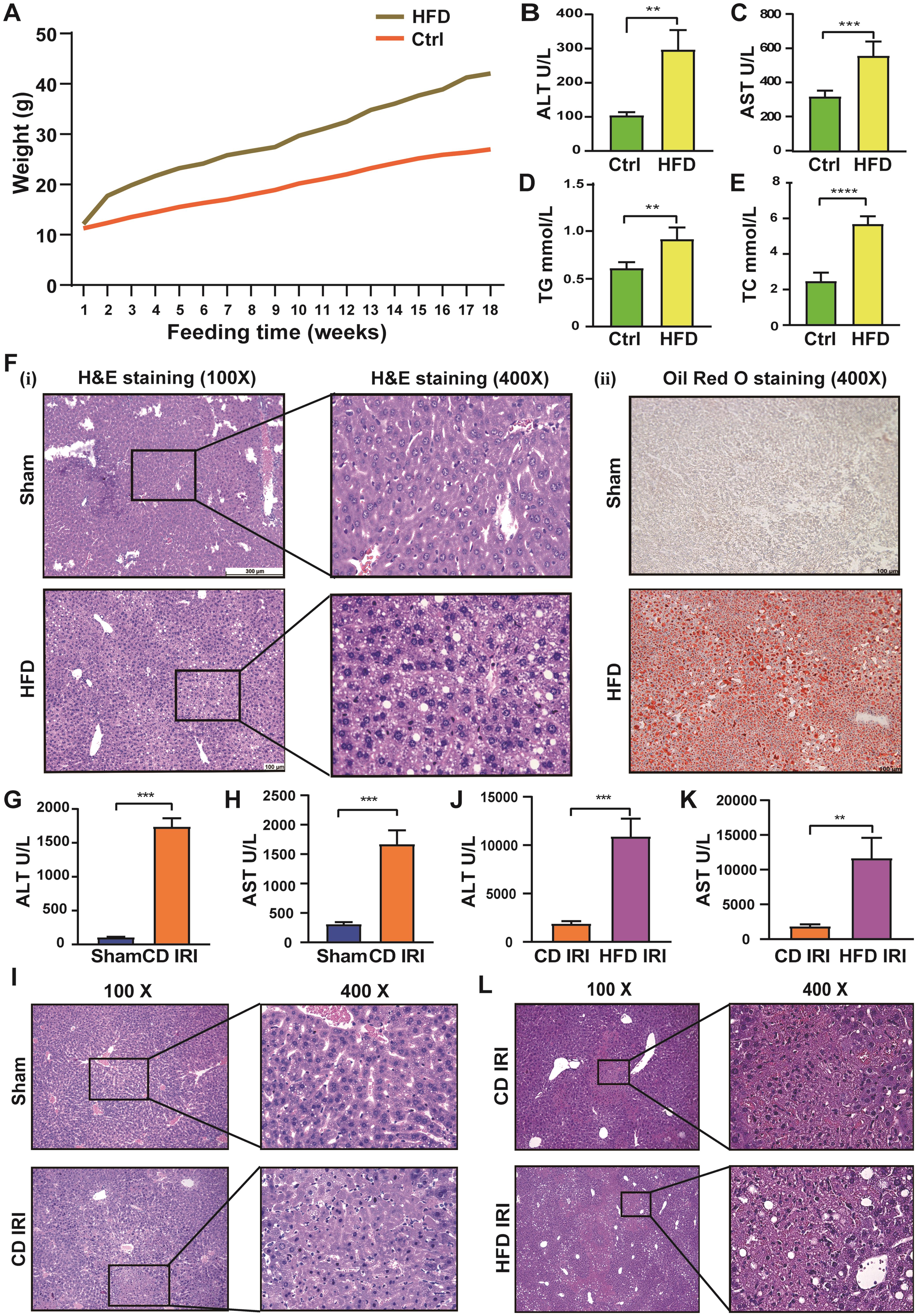 Ischemia-reperfusion injury was significantly increased in mice with fatty livers.