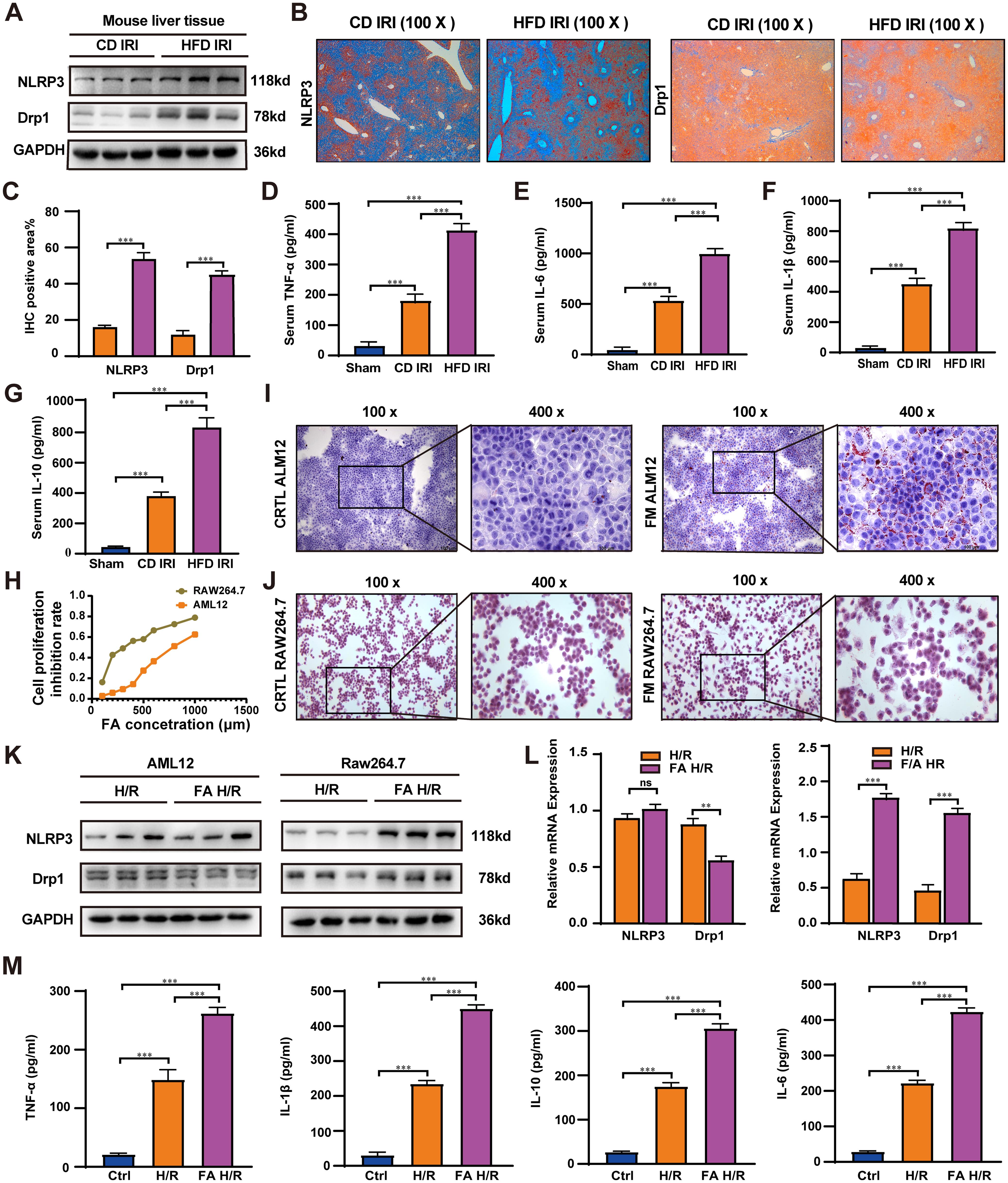 Kupffer cells aggravate ischemia-reperfusion injury in hepatic steatosis by upregulating Drp1 and NLRP3.